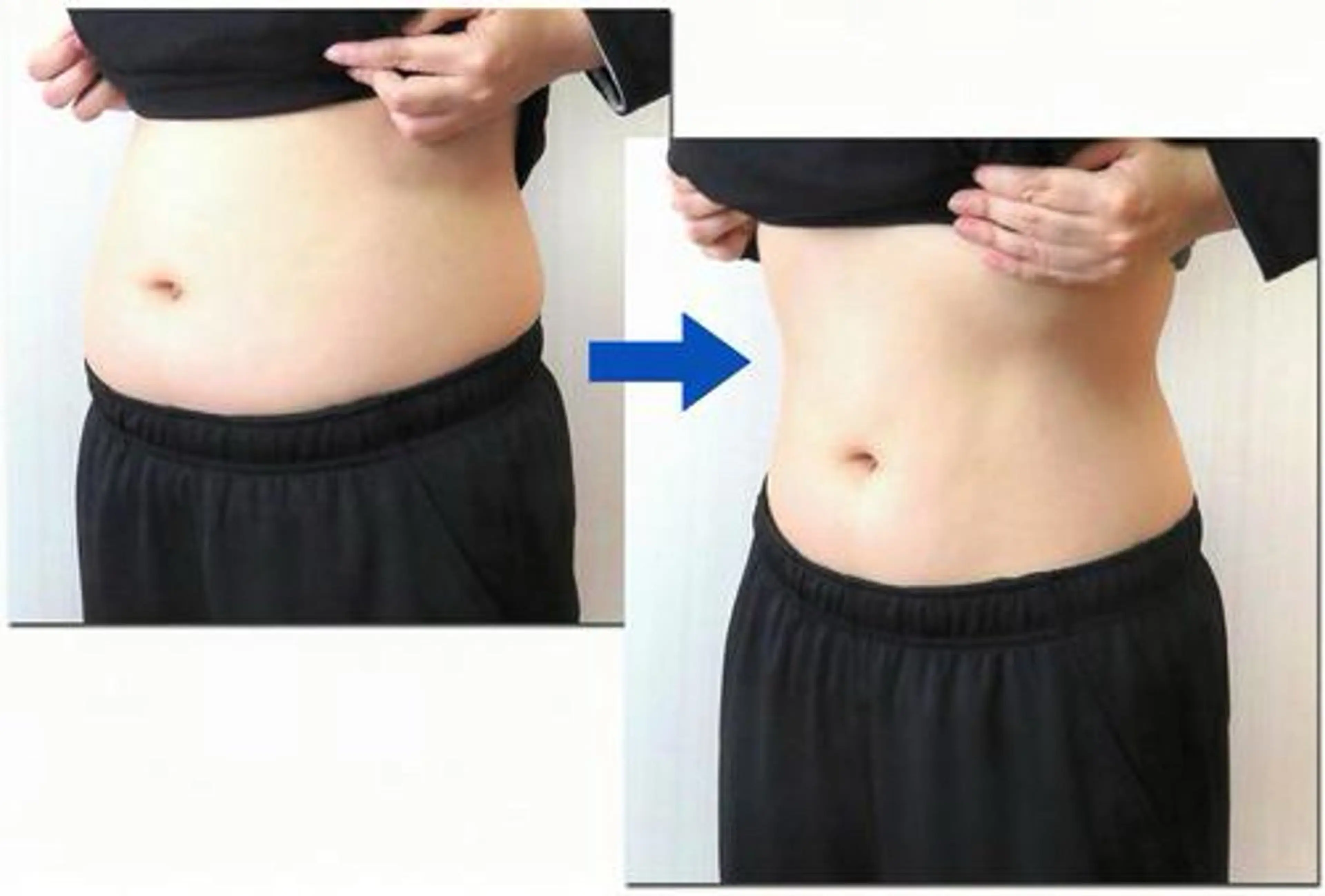 【食事制限が続かなかった方へ】3ヶ月で無理なく痩せる初回ダイエットカウンセリングの写真