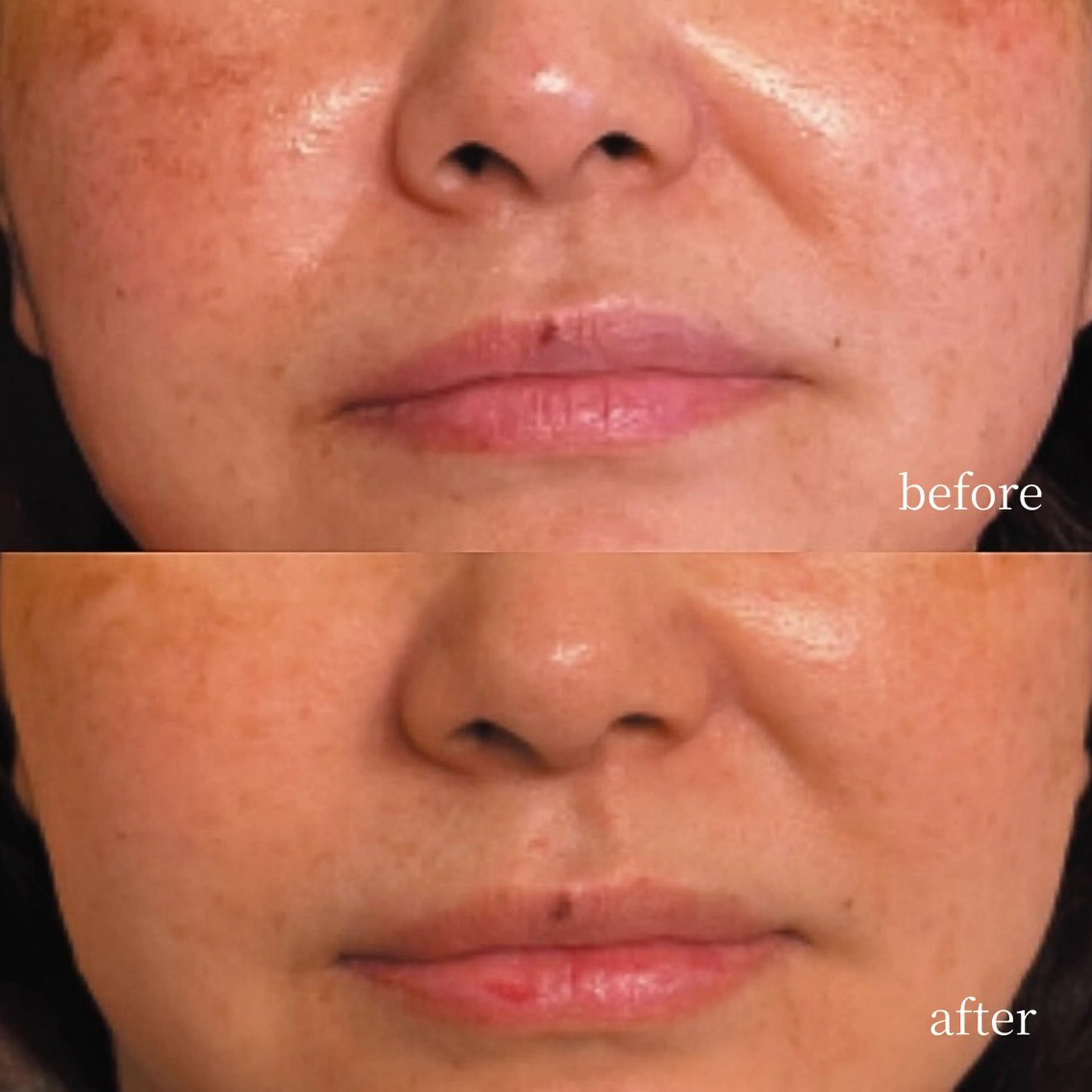 韓国肌管理・肌質改善 EARNEST心斎橋のエステ・リラクイメージ