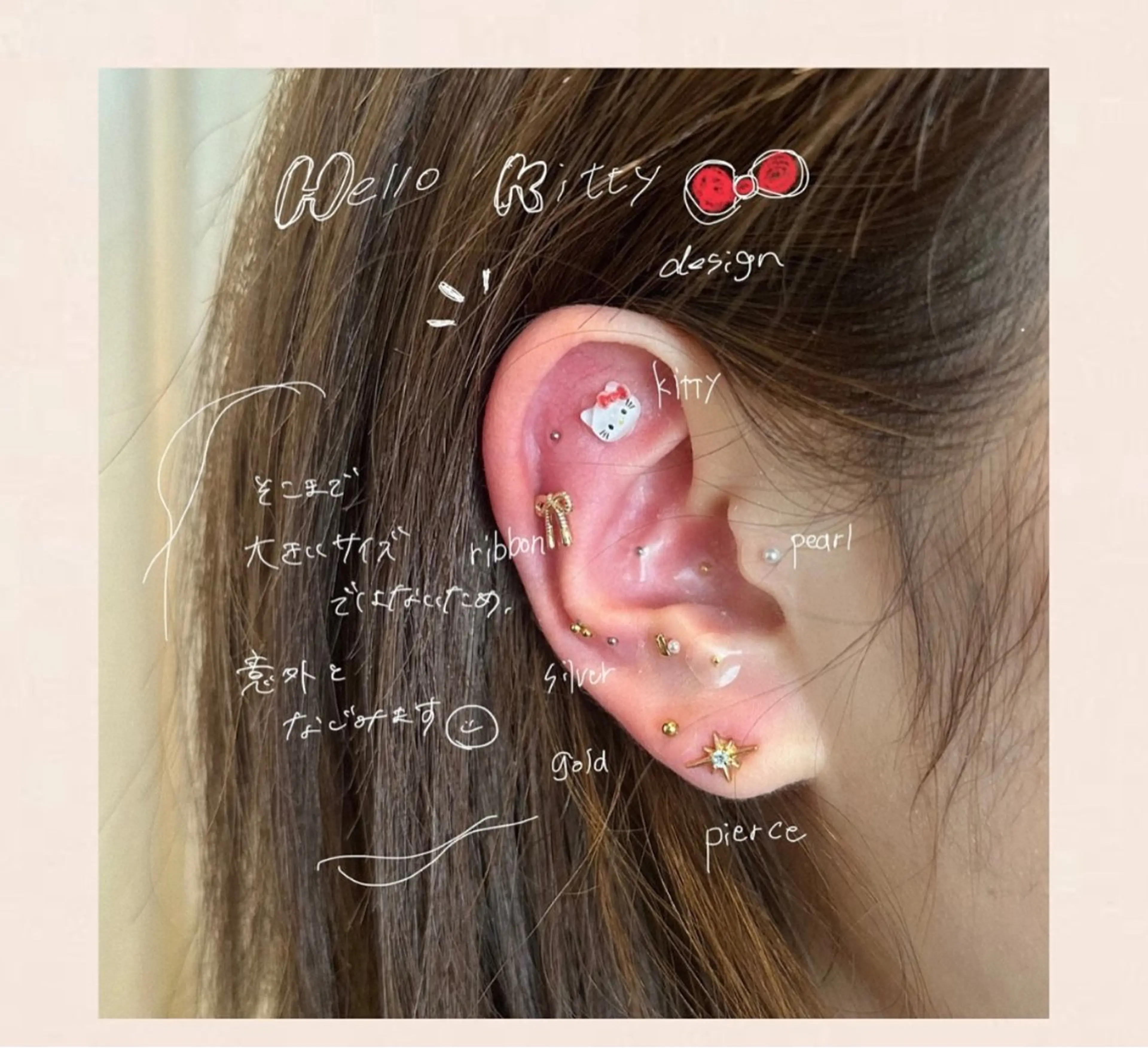 その他 エステサロン-mignon-所属・mignon 脱毛/ ローマピンク/耳ツボのその他イメージ