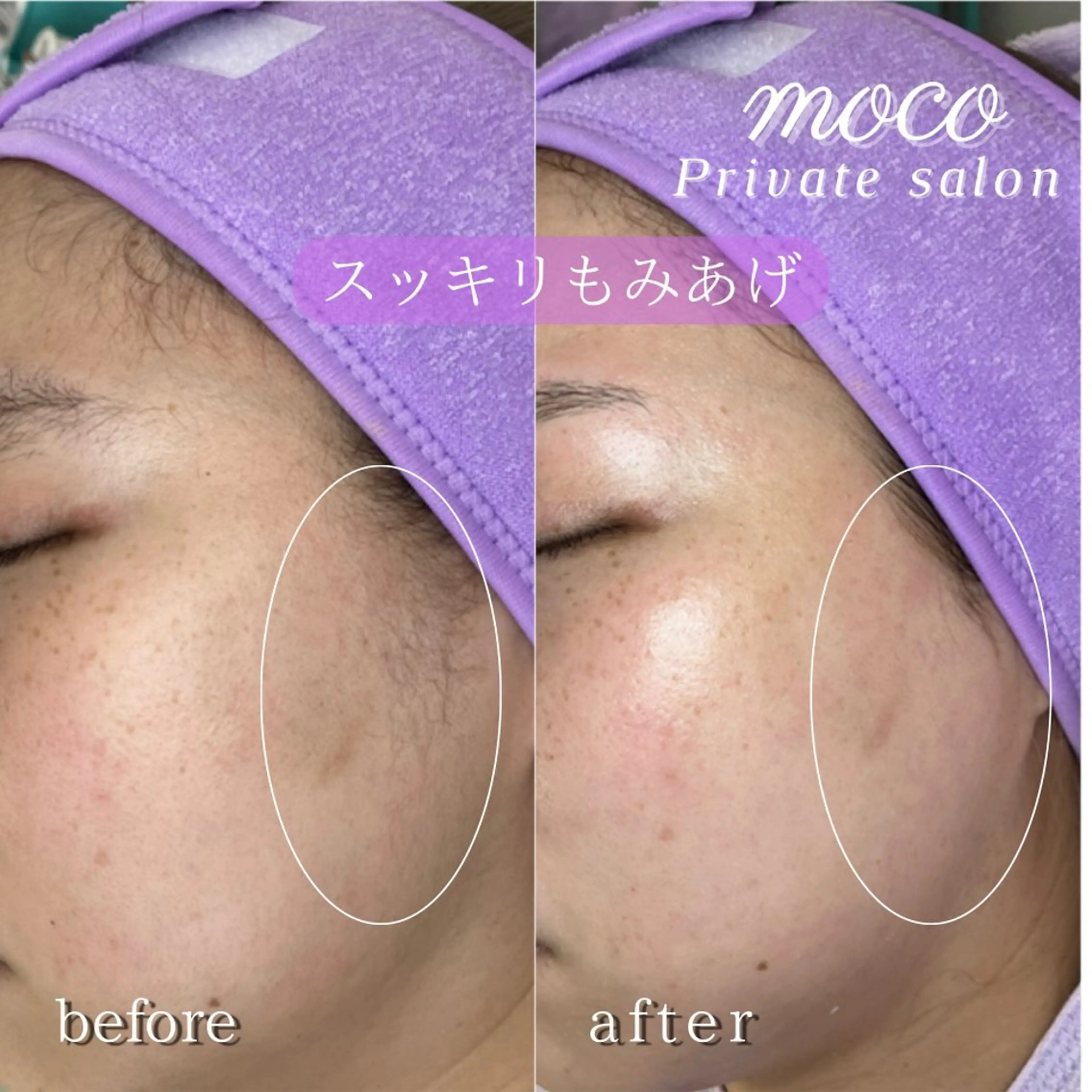 マツエク・マツパ アイブロウ まつ毛&ワックス脱毛 tomoの眉毛・アイブロウイメージ