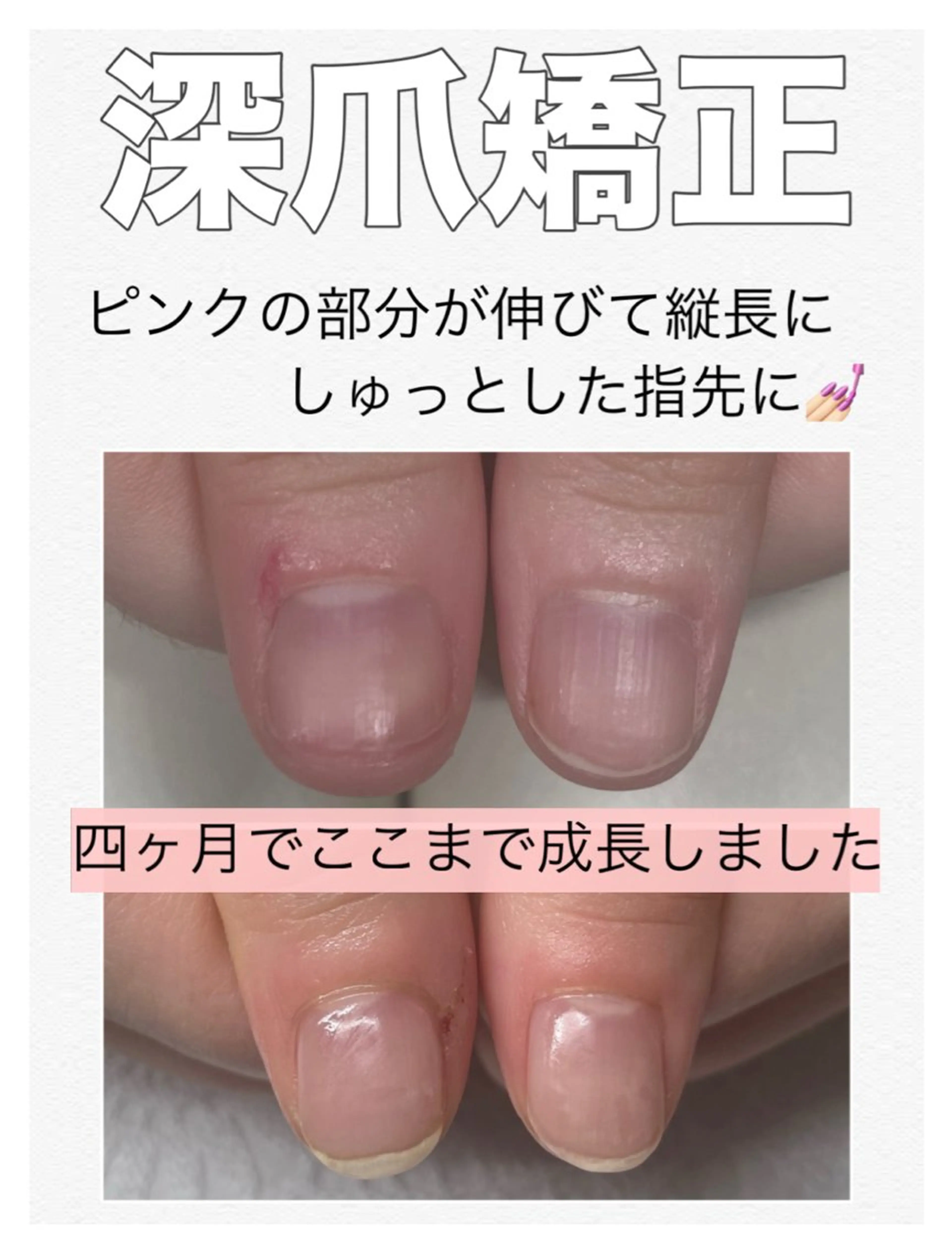 ネイル クリアネイル ピンク ハンドネイル ハンドケア nail salon petillantのネイルデザイン