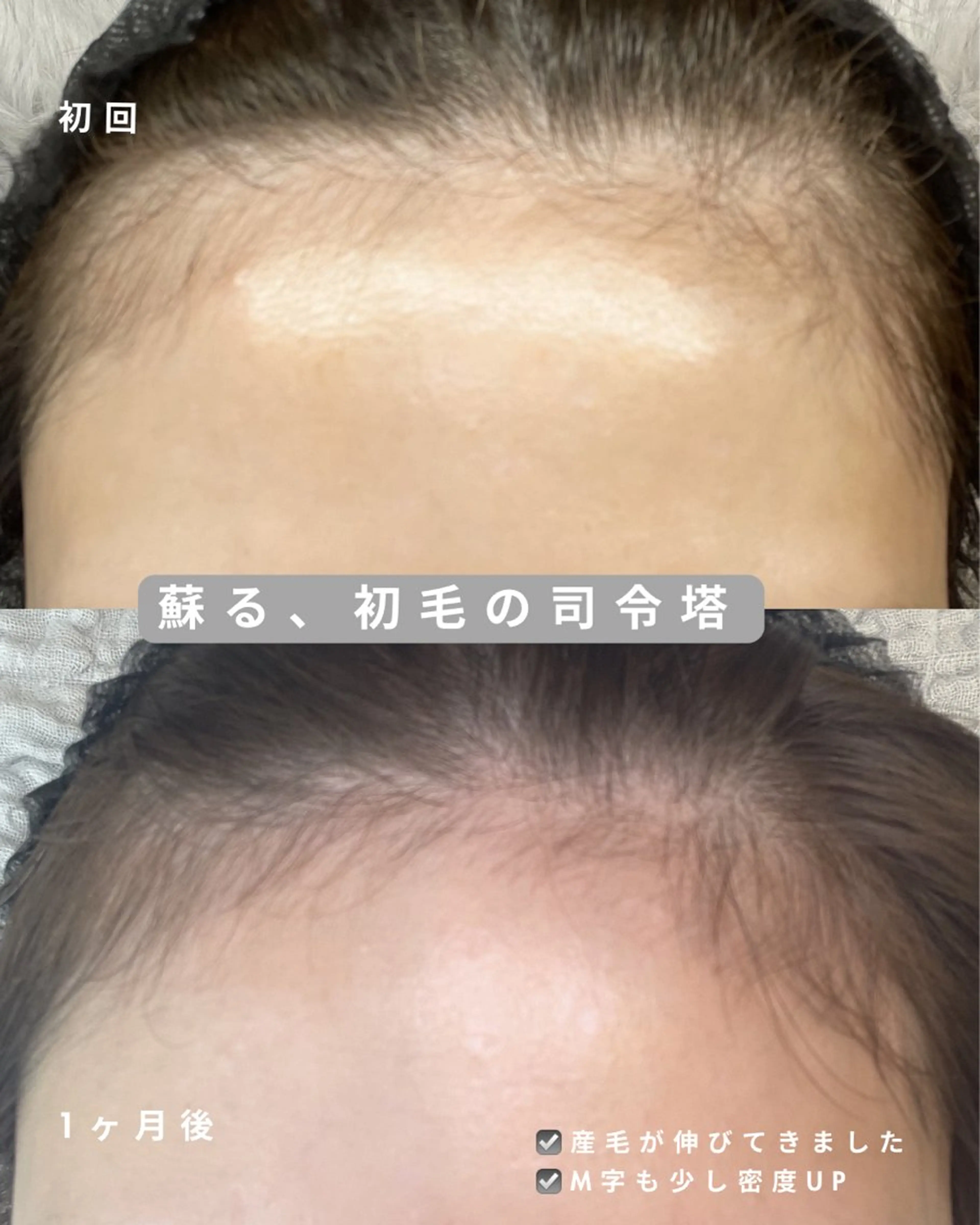 ヘッドスパ cocofleur ココフルールのエステ・リラクイメージ