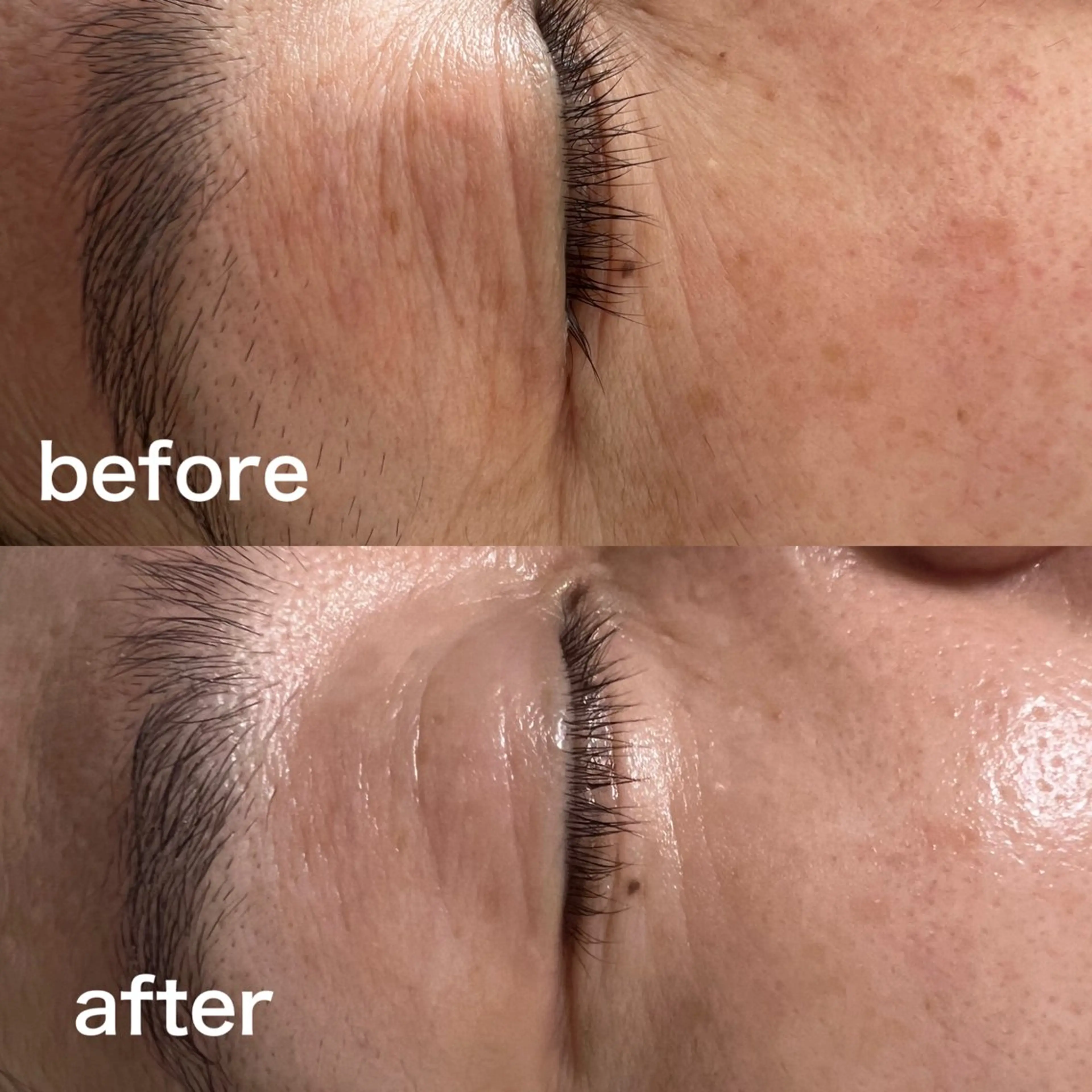 エステ 香川 瑞萌のエステ・リラクイメージ