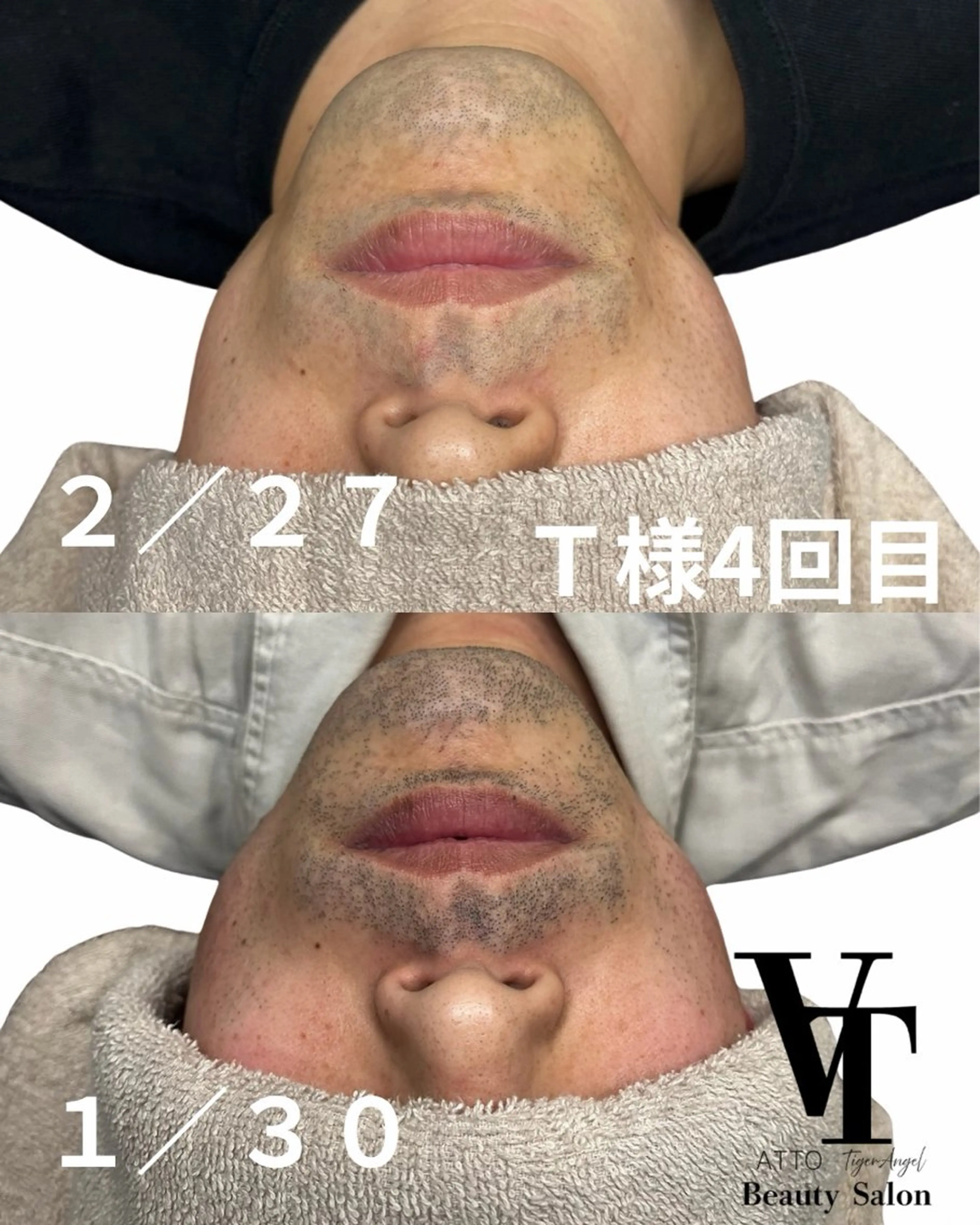 メンズ ATTO SHIORIのエステ・リラクイメージ