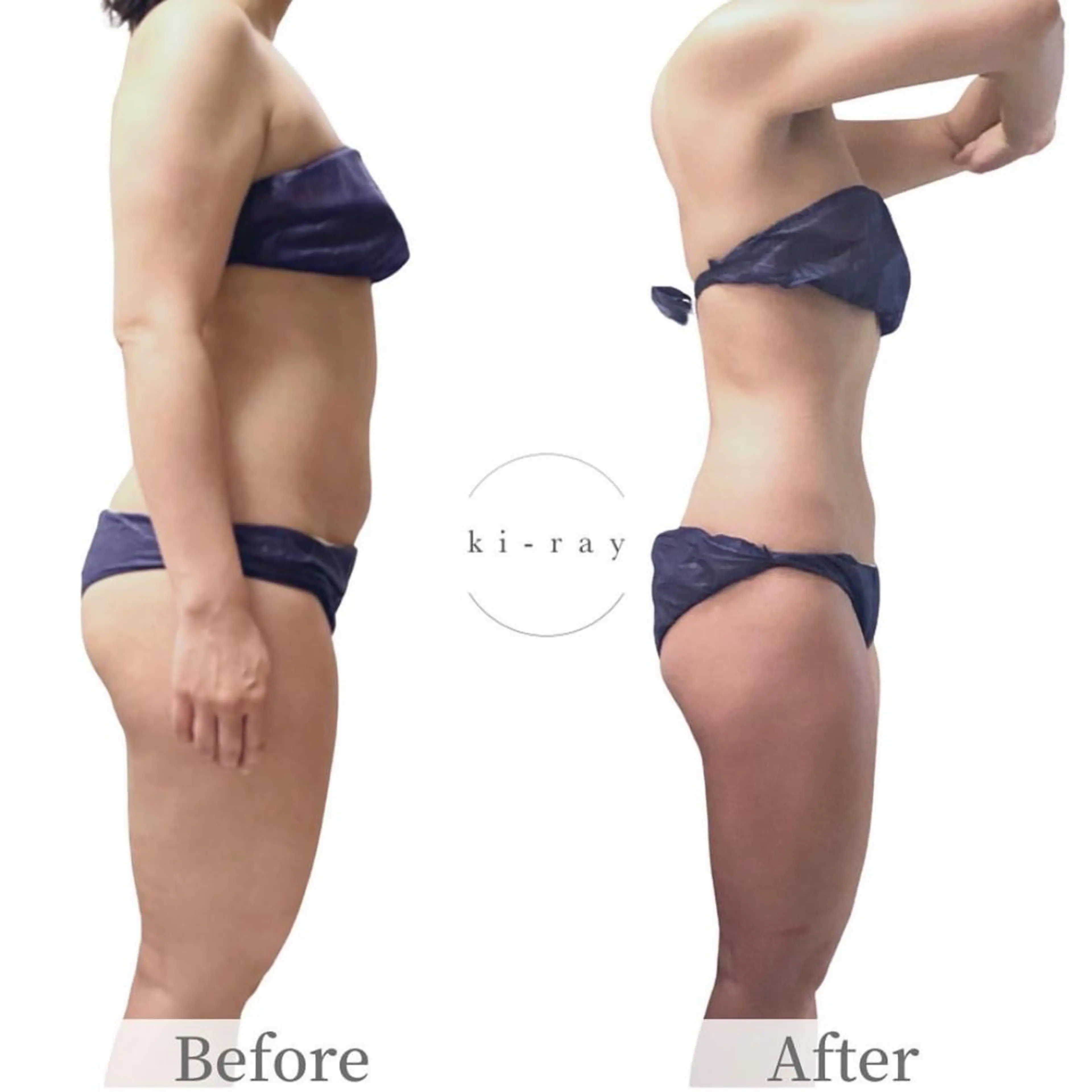 エステ 綺麗のひみつ グランプリ受賞店のエステ・リラクイメージ