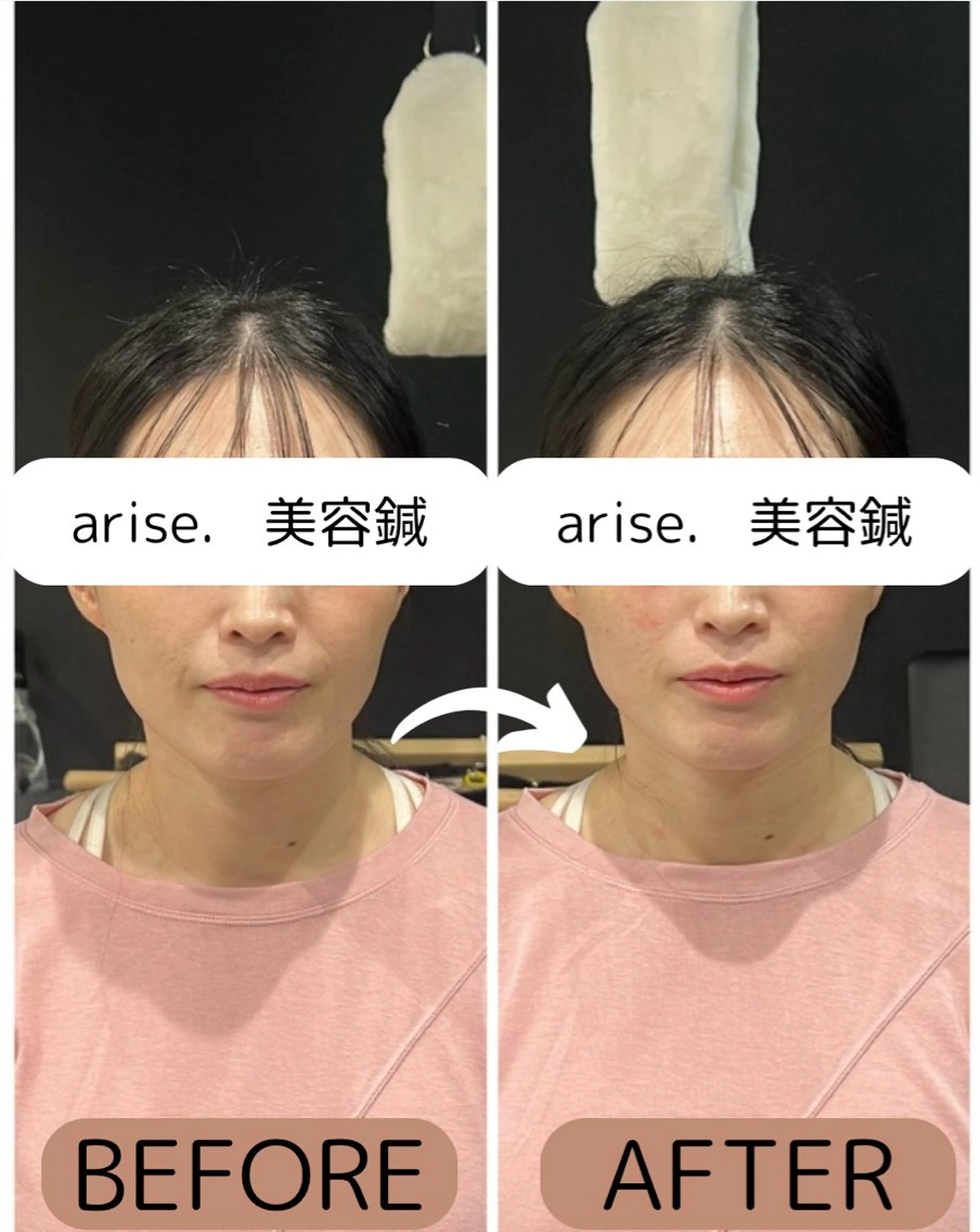 その他 東広島美容鍼 /arise.のその他イメージ