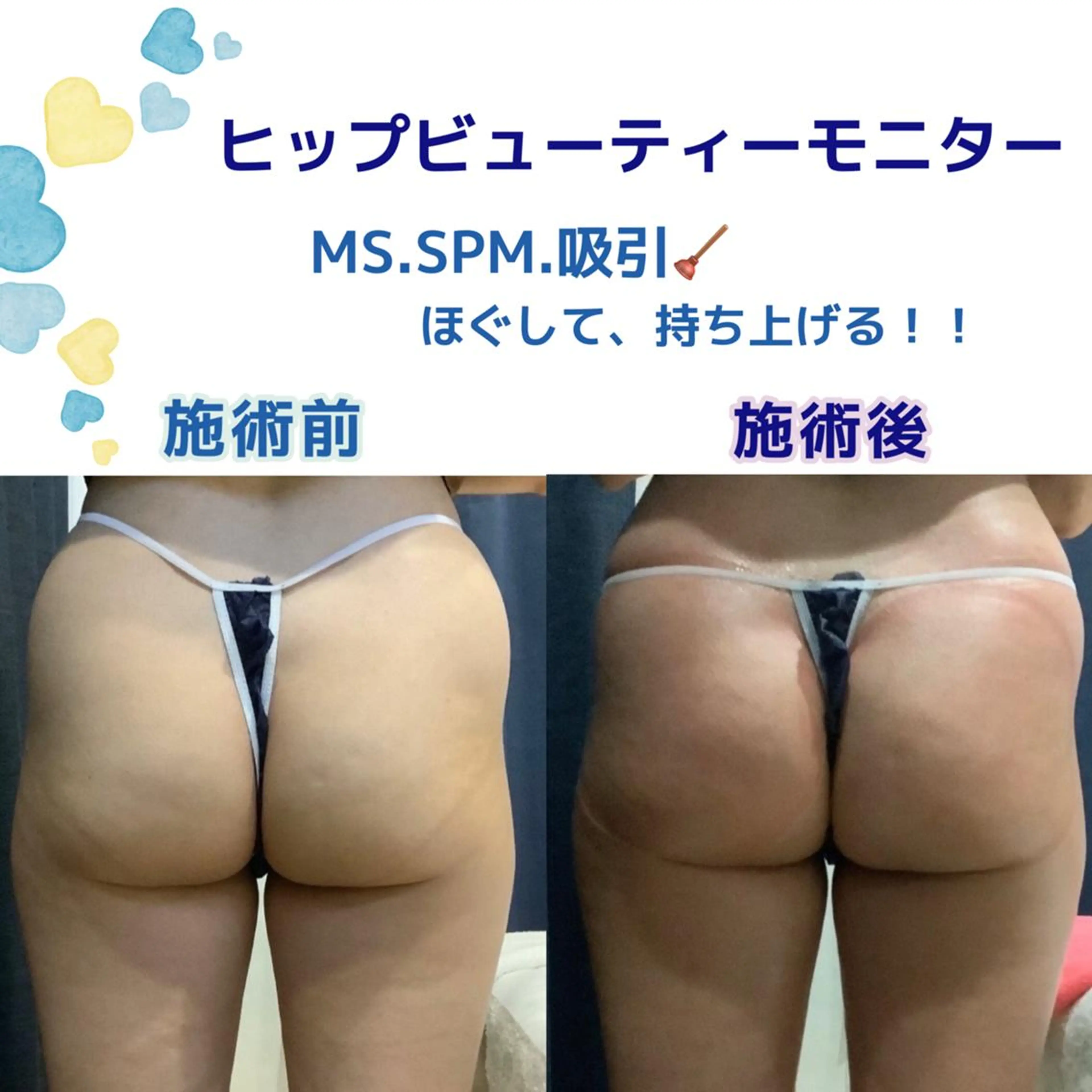 エステ リラク エルフラージュ 銀座店のエステ・リラクイメージ