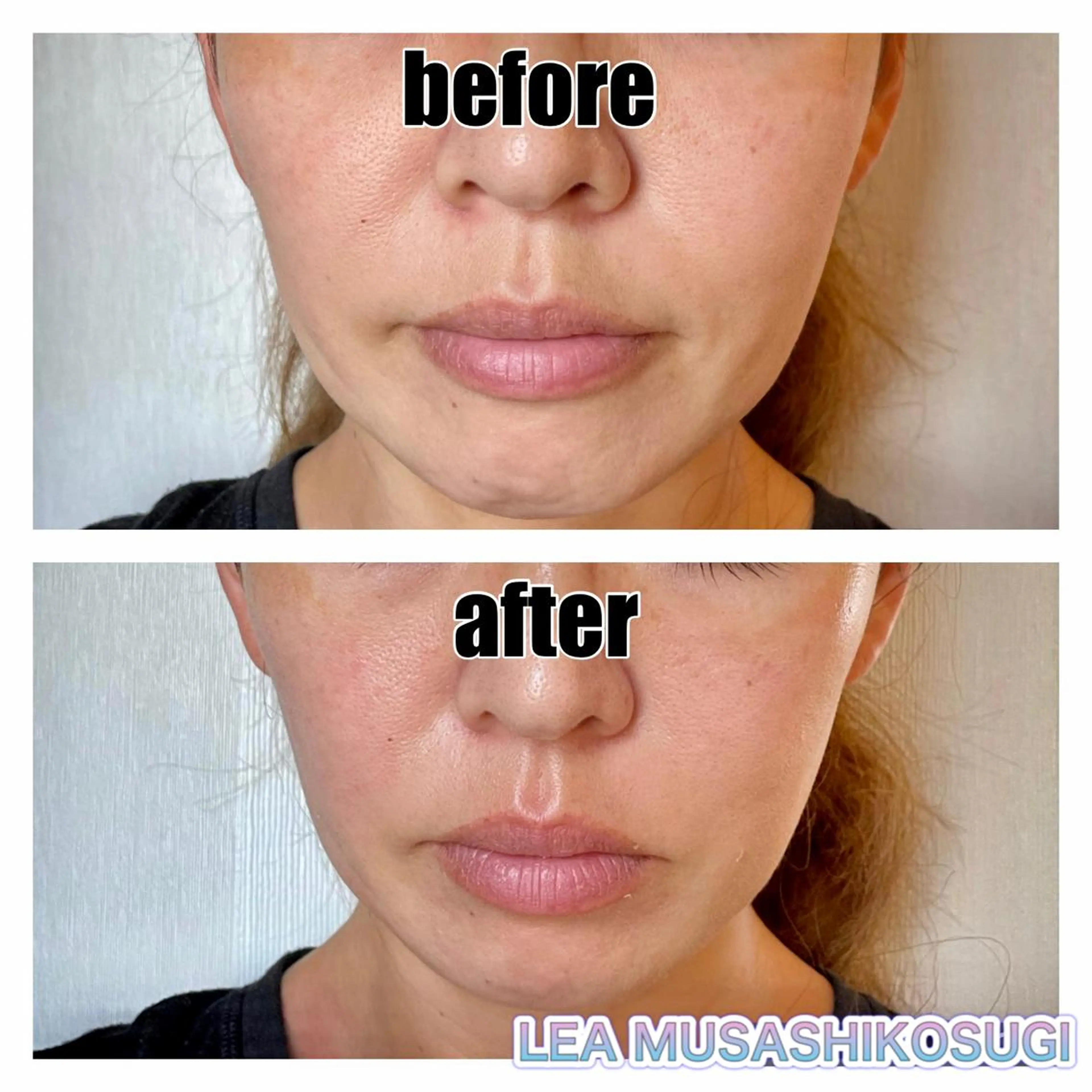 美肌育成サロン LEA武蔵小杉のエステ・リラクイメージ