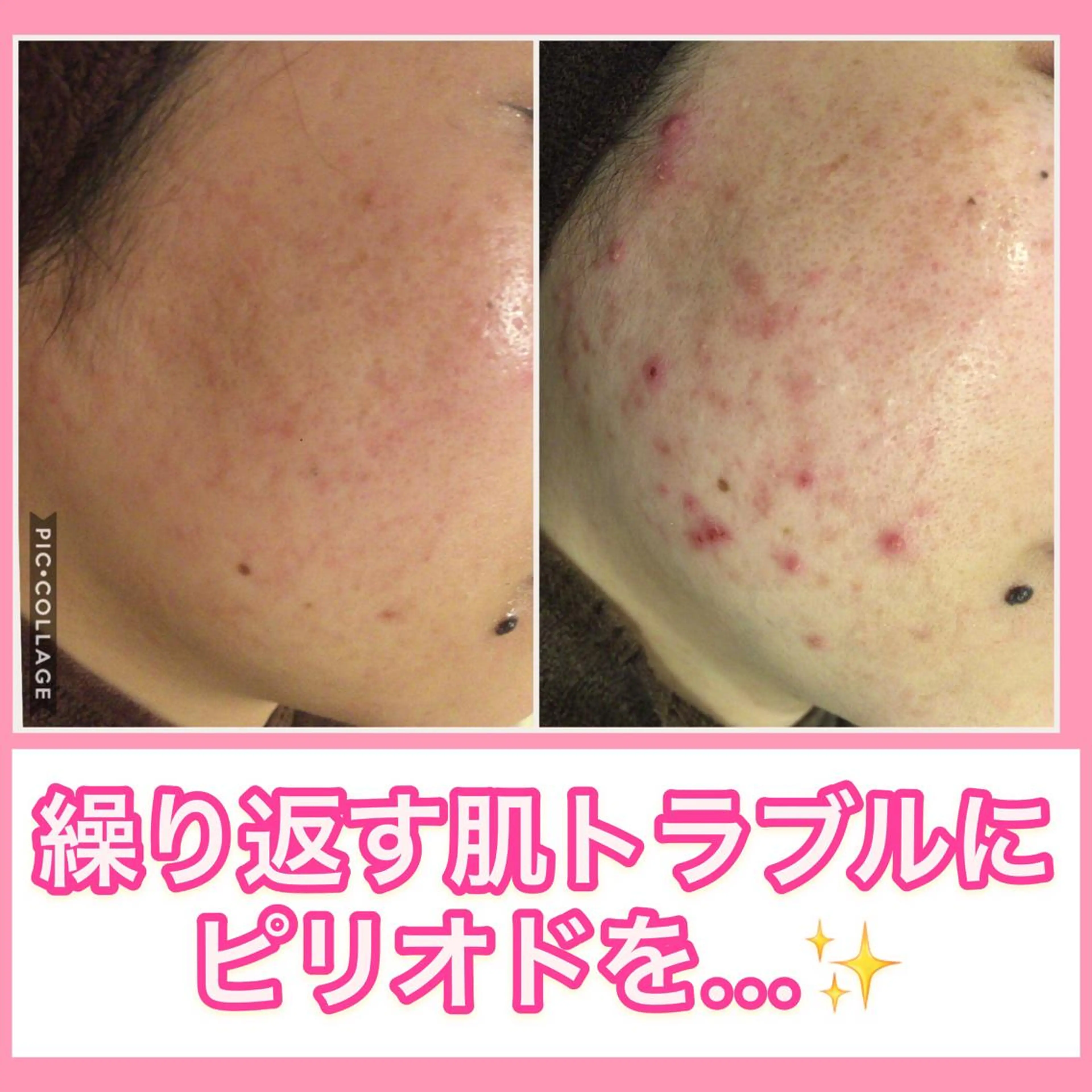 ミディアム カラー パーマ ヘアアレンジ メンズ キッズ ネイル マツエク・マツパ ニキビ・肌質改善専門 ♡人生が変わるサロンのエステ・リラクイメージ