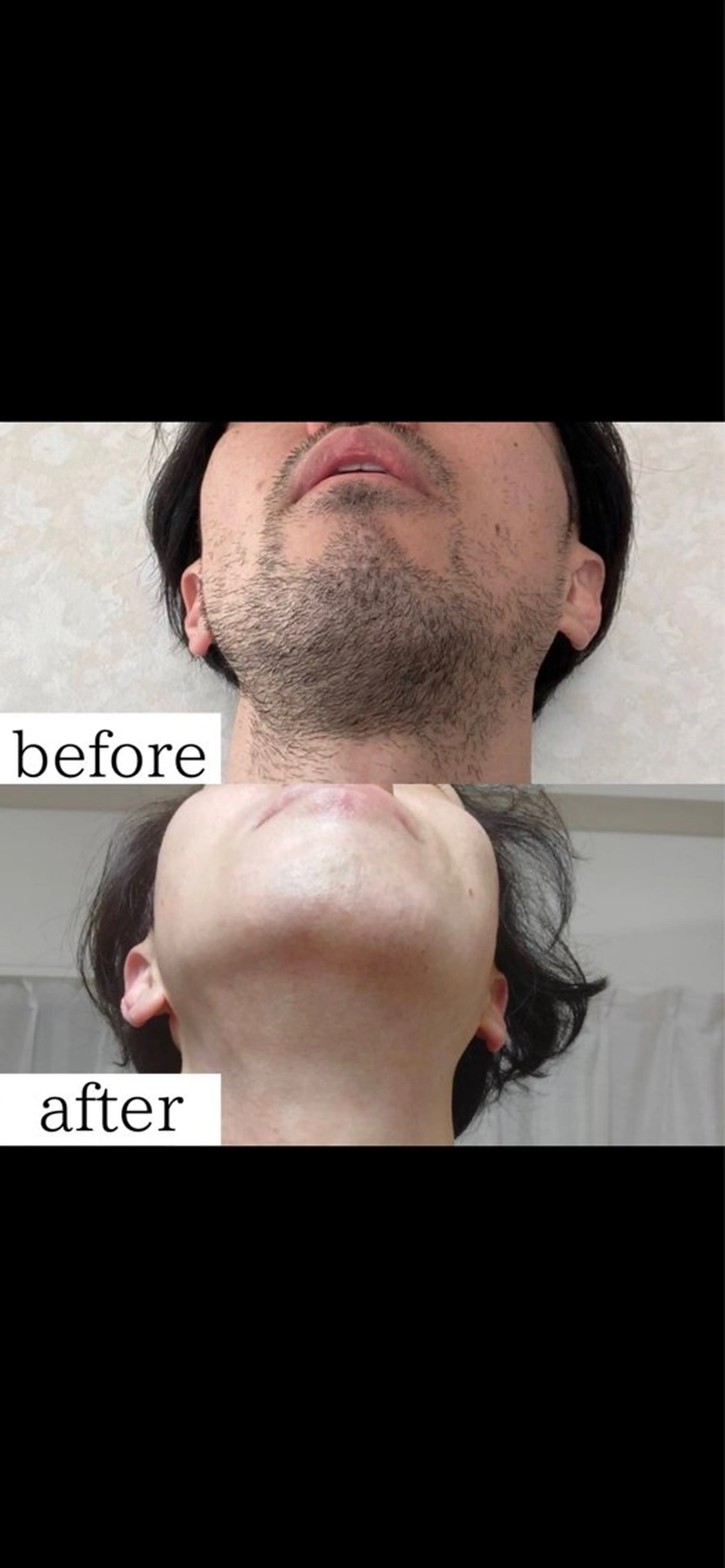 メンズ 脱毛 みんなの脱毛 TSURURINのエステ・リラクイメージ