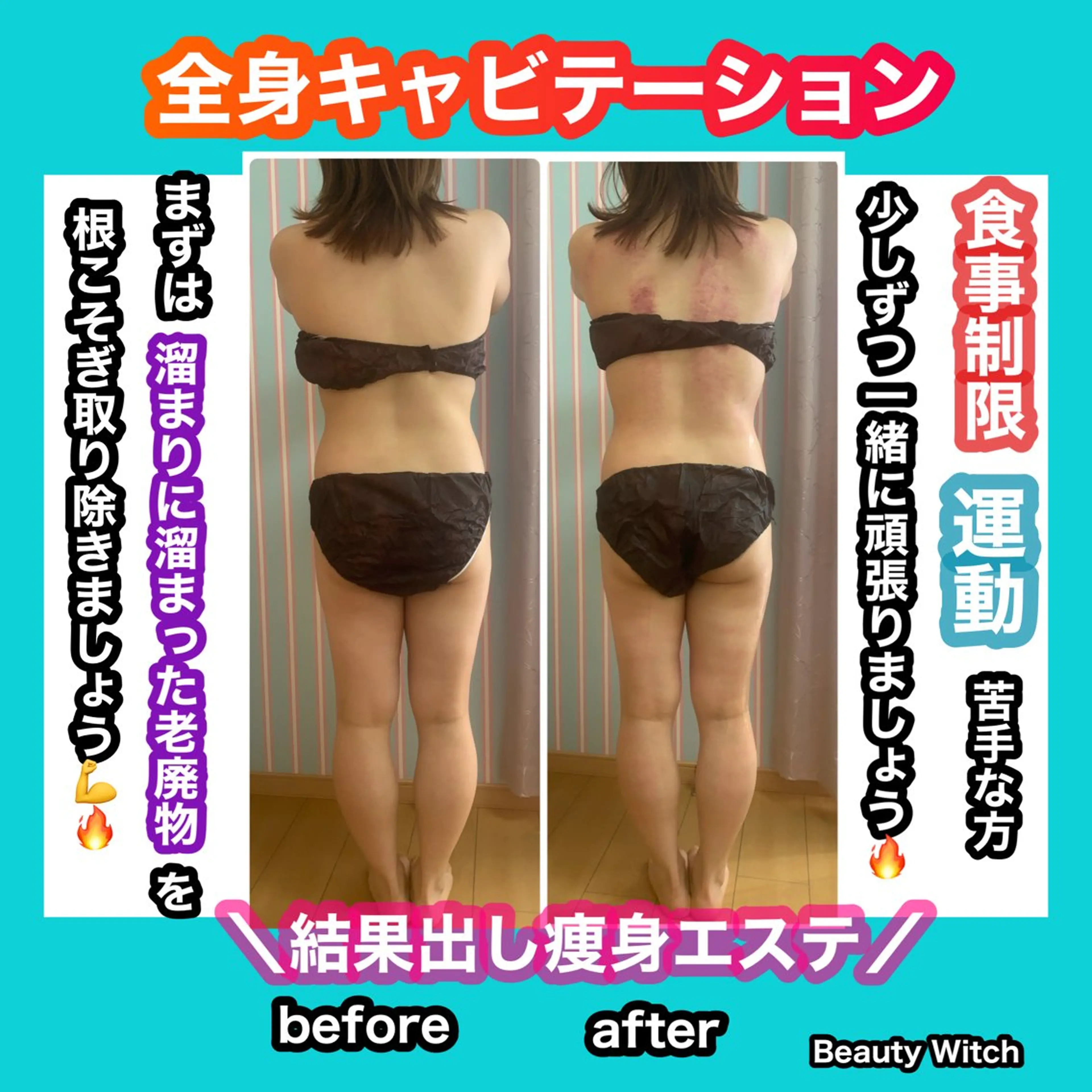 エステ リラク 痩身/脱毛/ネイル HARUKAのエステ・リラクイメージ