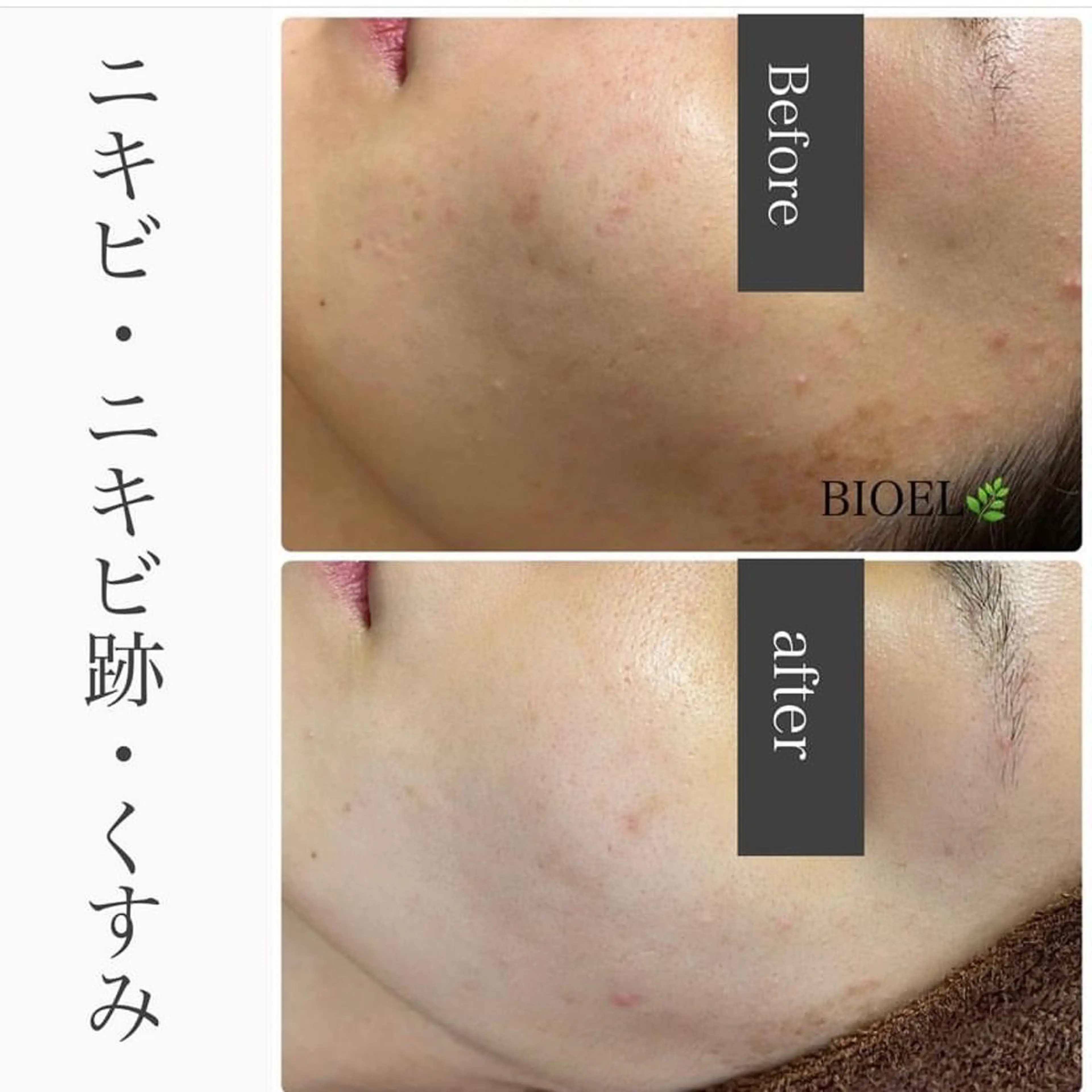 ハーブピーリング専門 BIOPLUS＋川崎のエステ・リラクイメージ