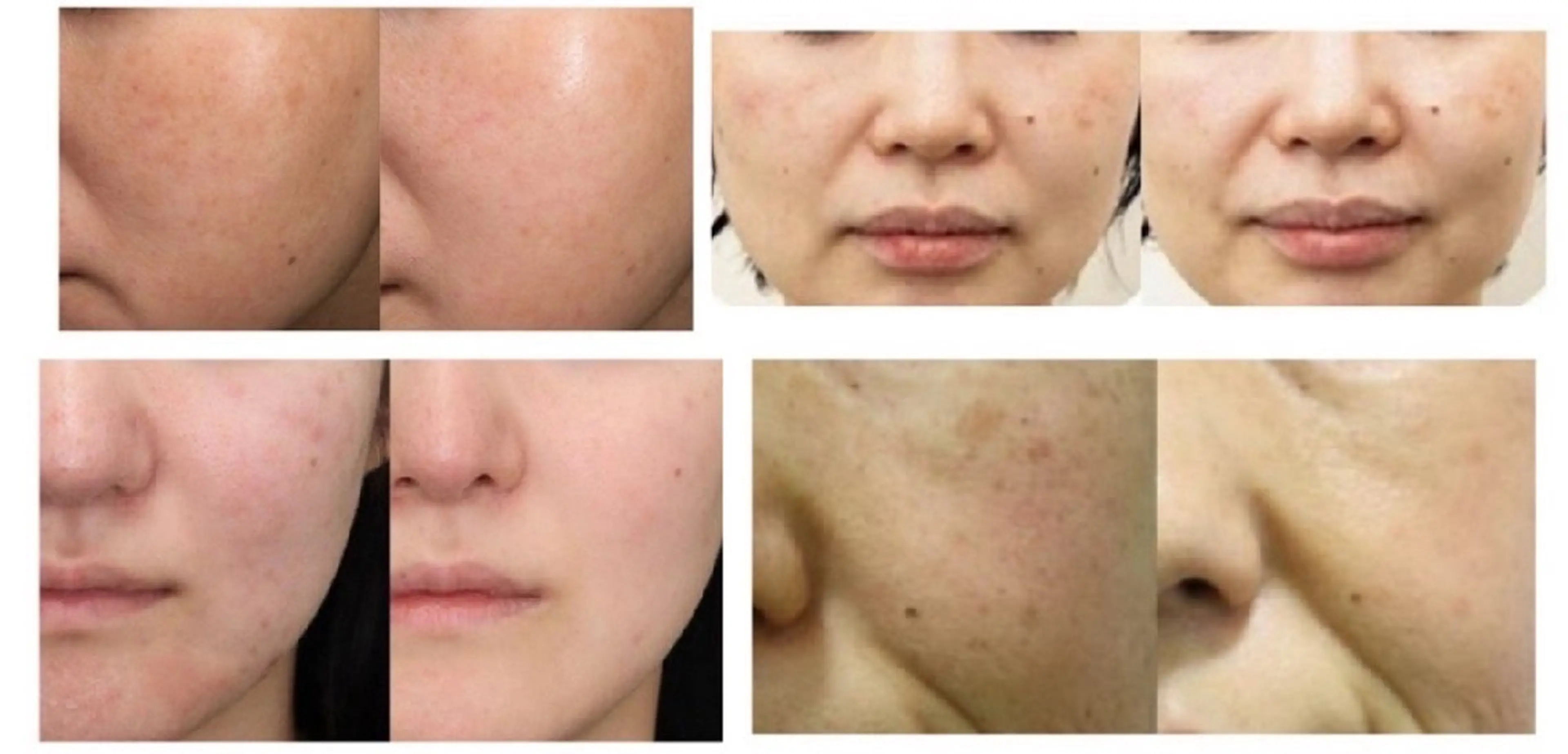 選べる美容液イオン導入の写真