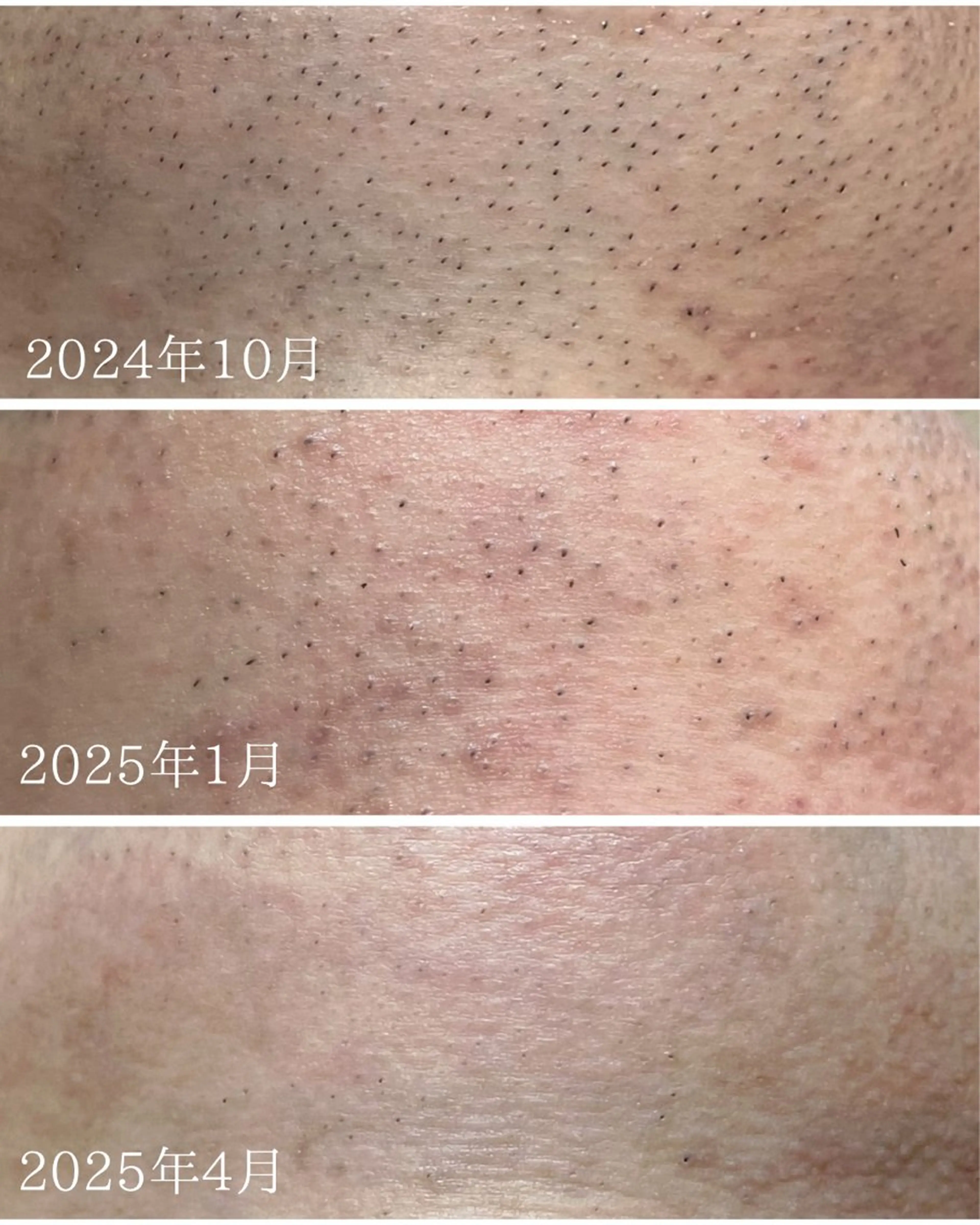 メンズ エステ Lys Blanc OTOKAのエステ・リラクイメージ