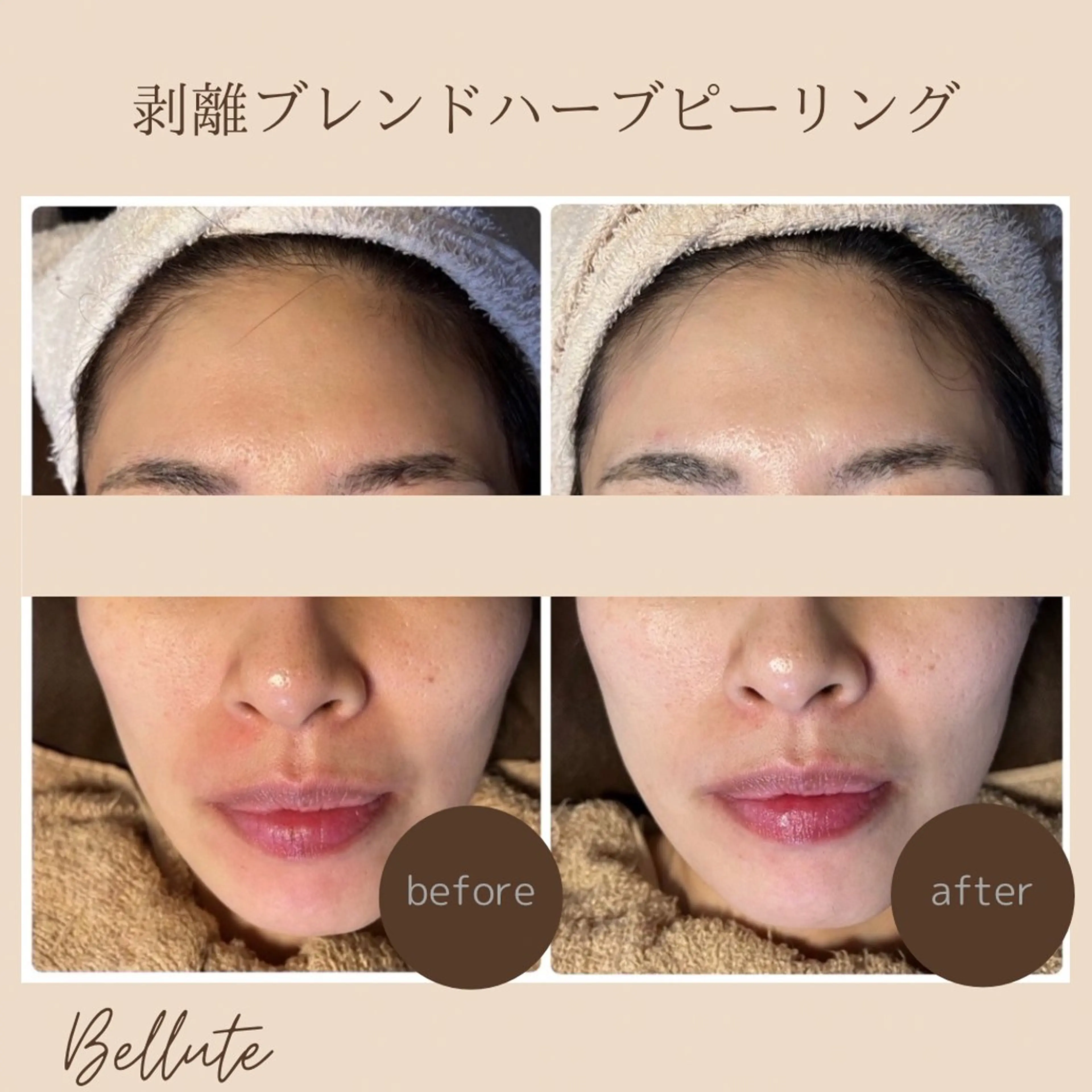 エステ リラク ピーリング専門店 Belluteのエステ・リラクイメージ