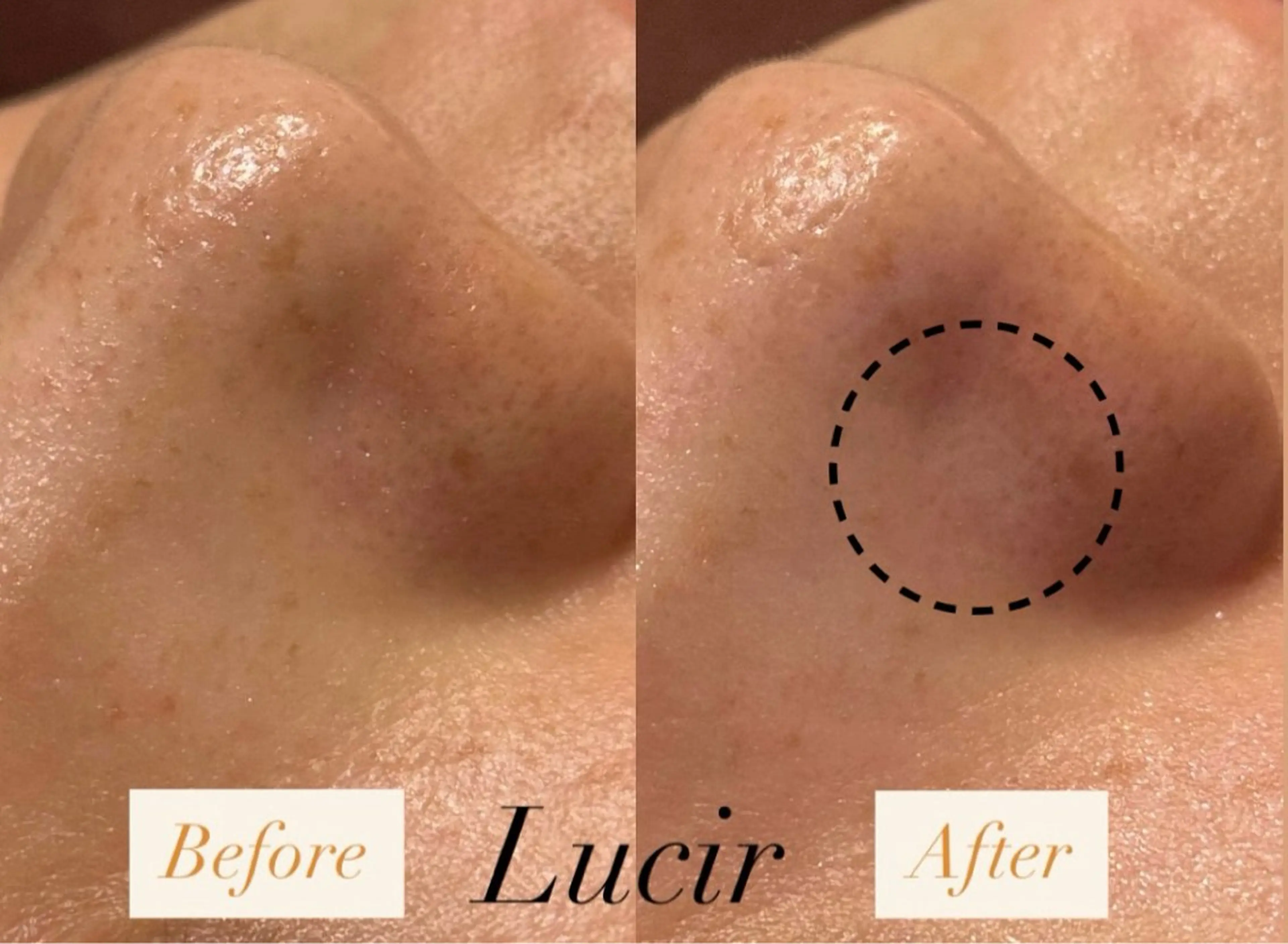 脱毛＆小顔コルギ 専門店 Lucirのエステ・リラクイメージ