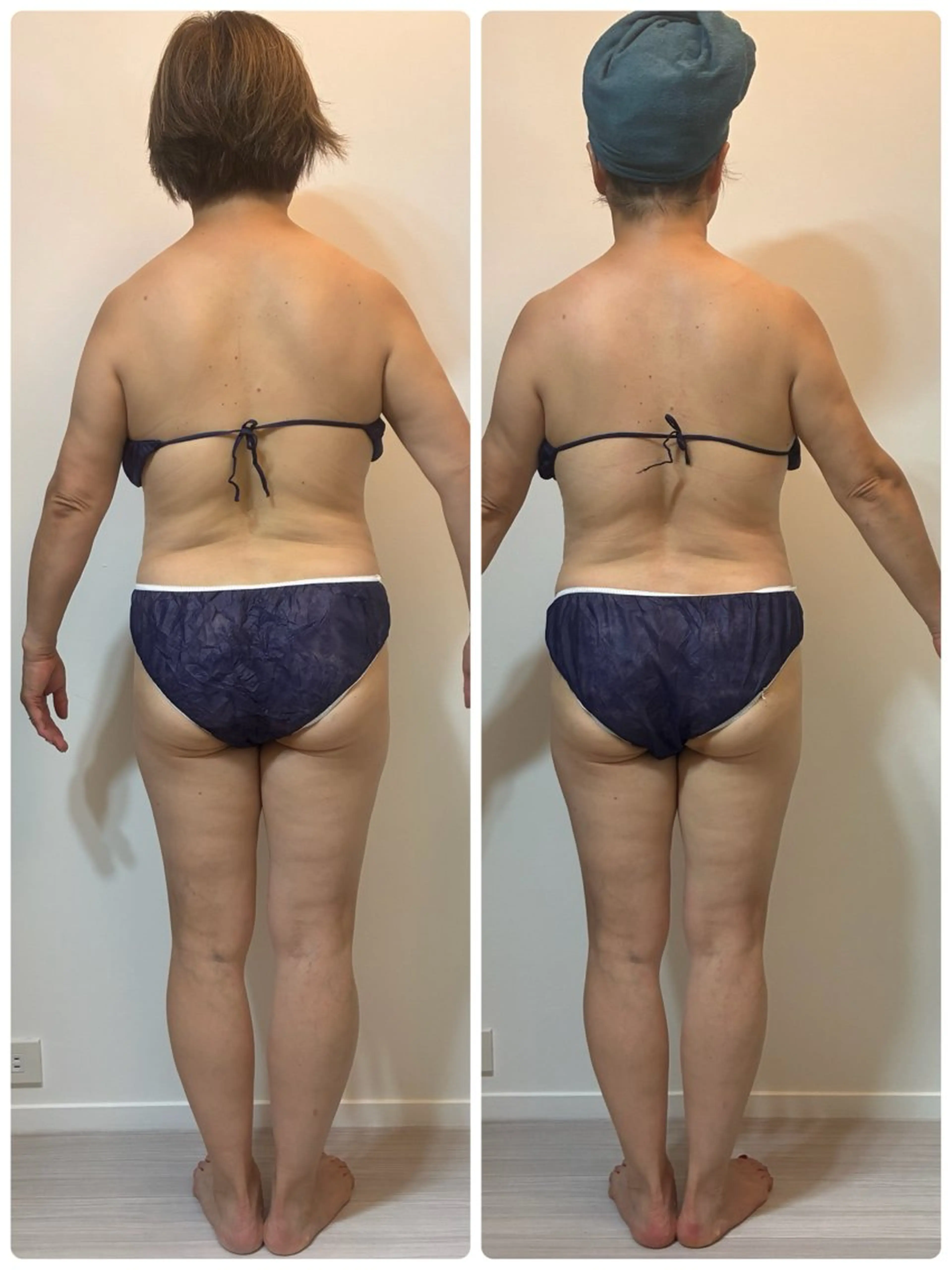 オールハンド筋膜痩身 整体/小顔　中山朝美のエステ・リラクイメージ