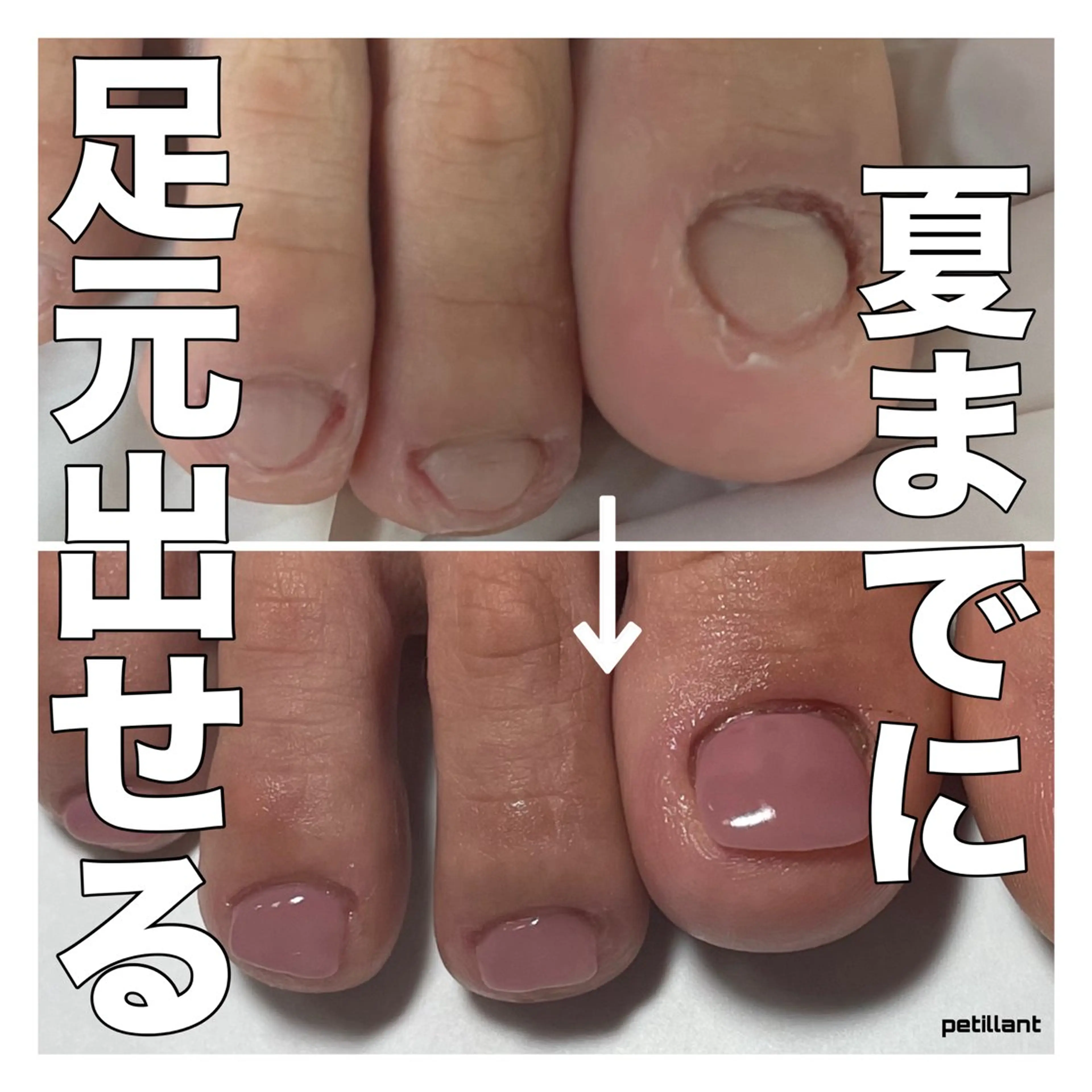 ネイル フットネイル ジェルネイル フットネイル nail salon petillantのネイルデザイン