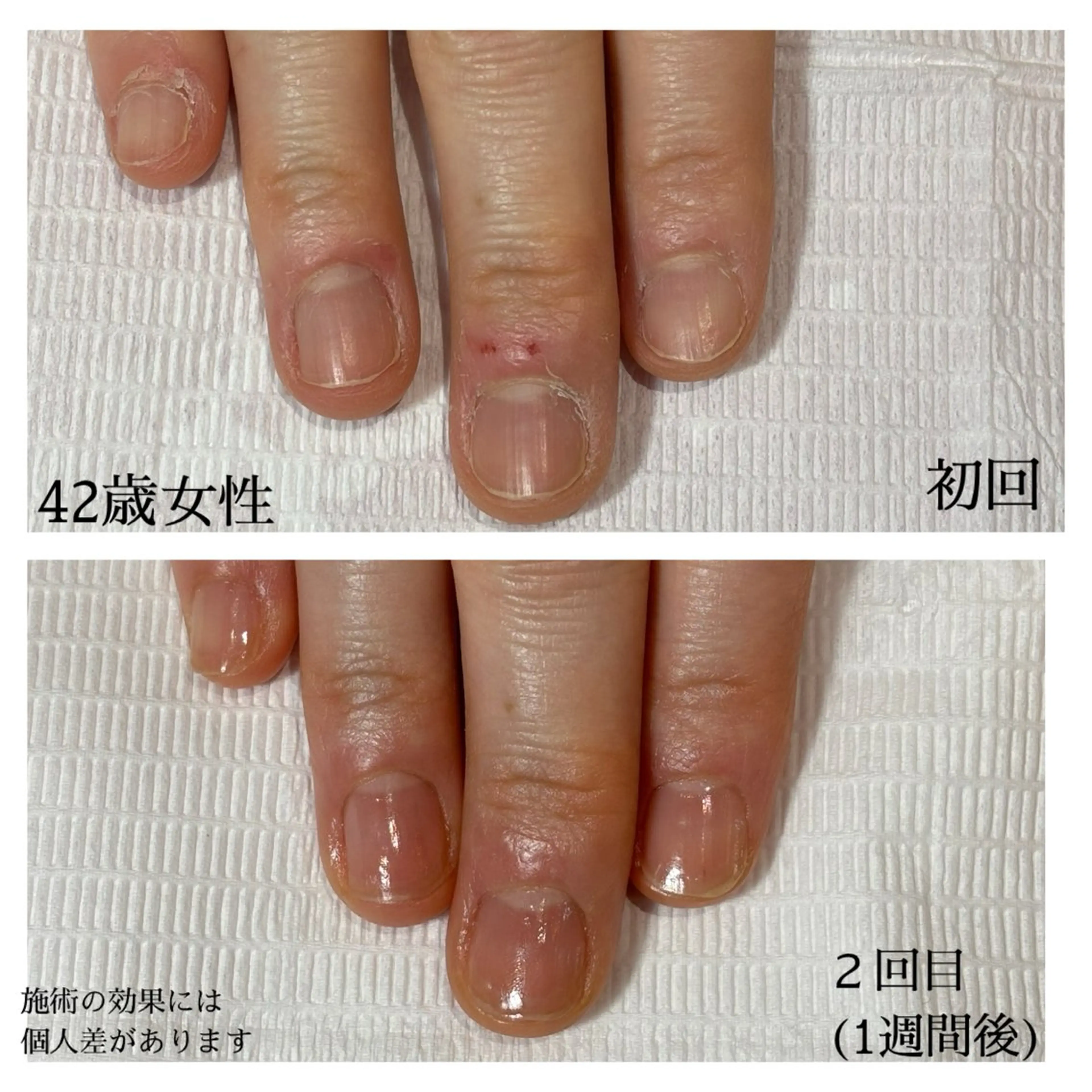 ネイル 自爪育成専門サロン エムロードゥ池下のネイルデザイン