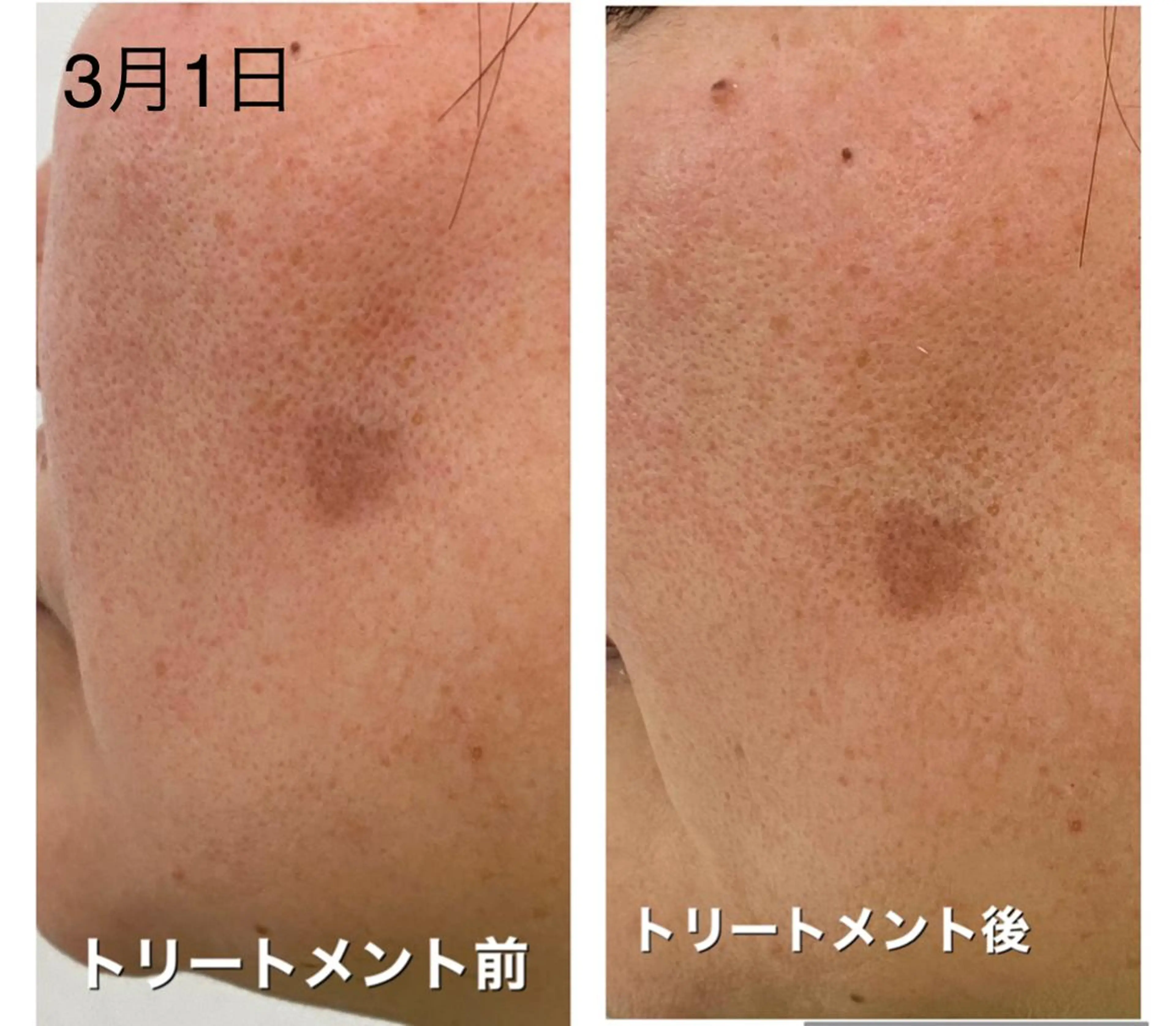 エステ ノエビア ラボーテサロンのエステ・リラクイメージ