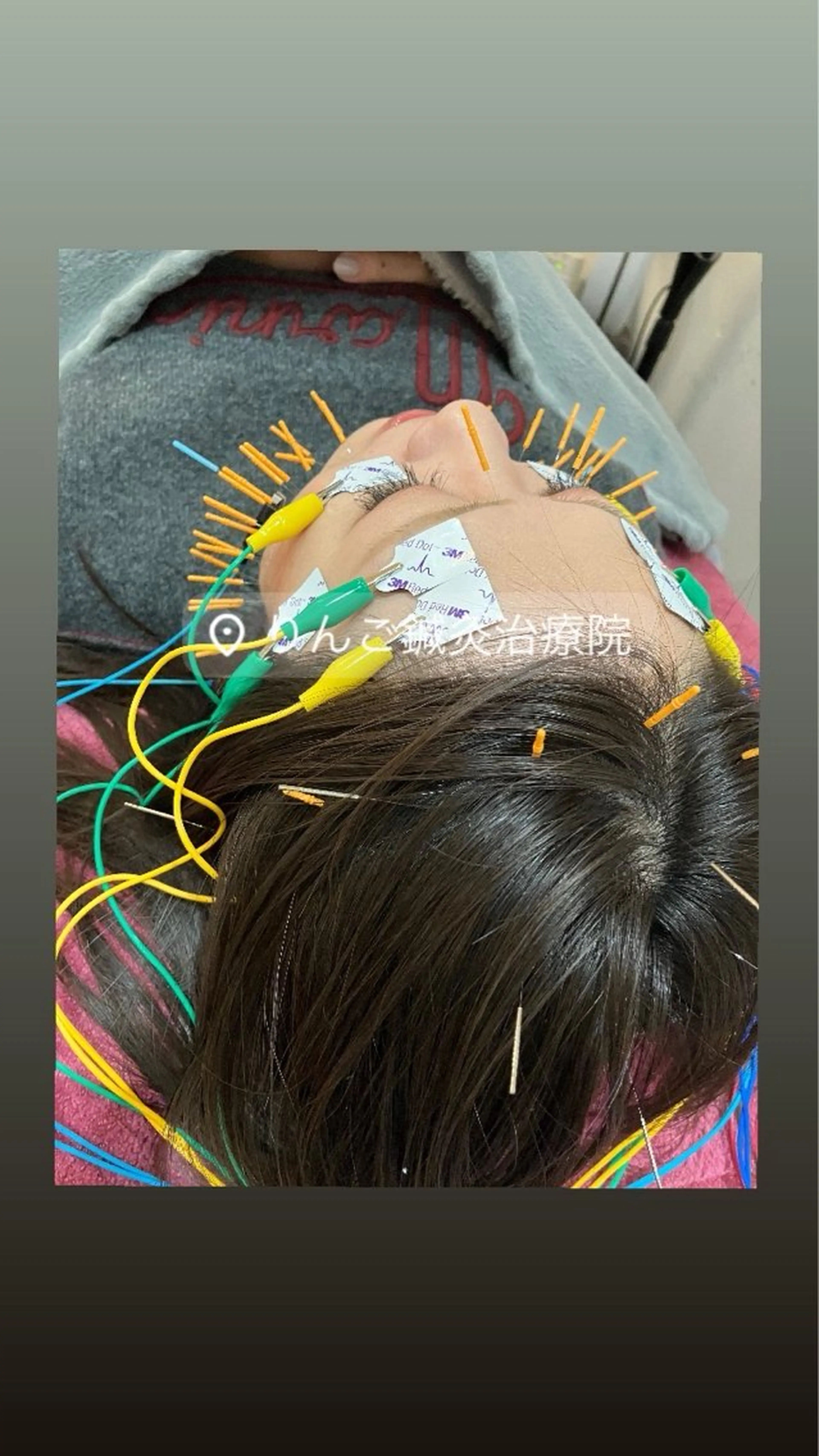 その他 美容鍼灸女性専用 りんご鍼灸治療院のその他イメージ