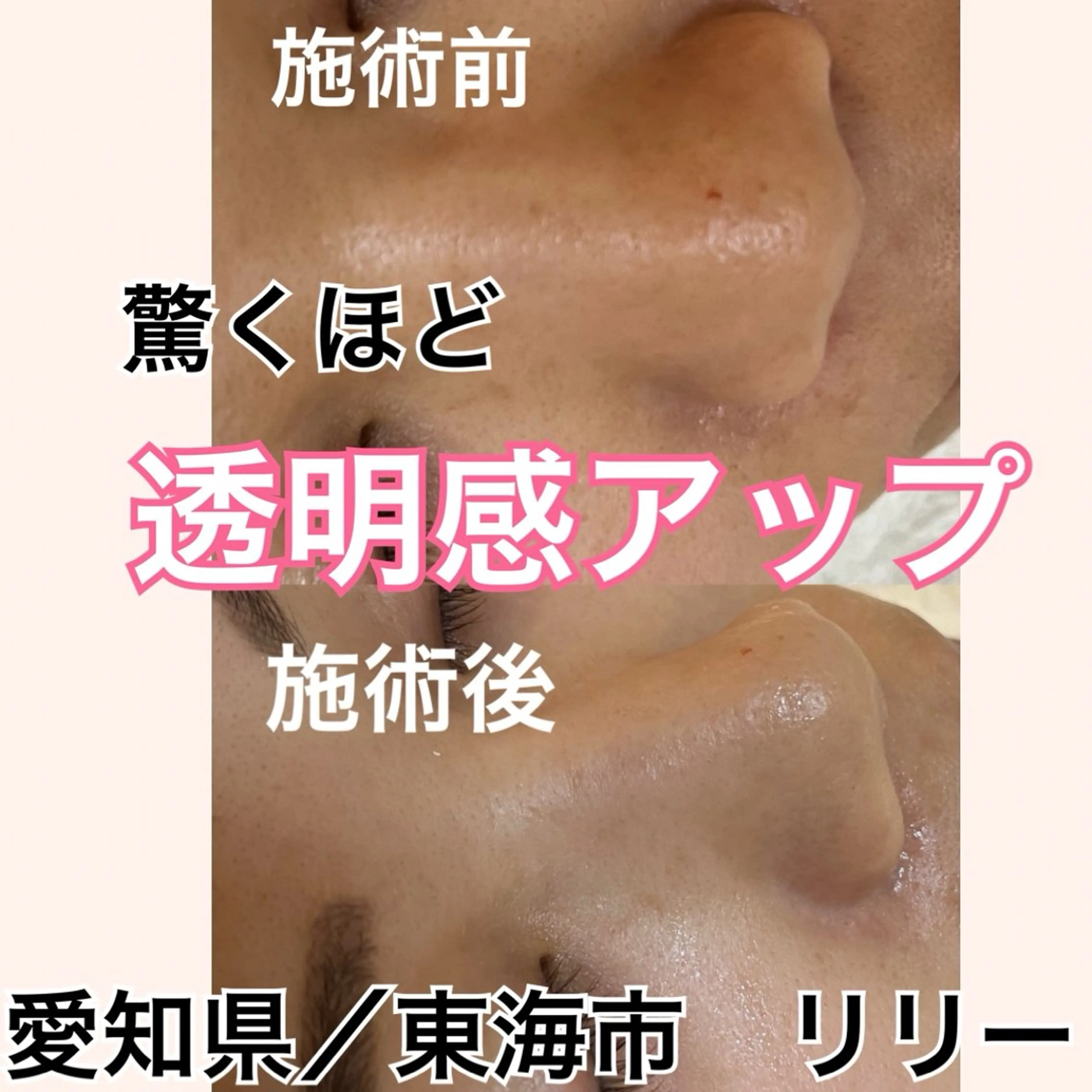 トータルビューティー サロンLilyのエステ・リラクイメージ