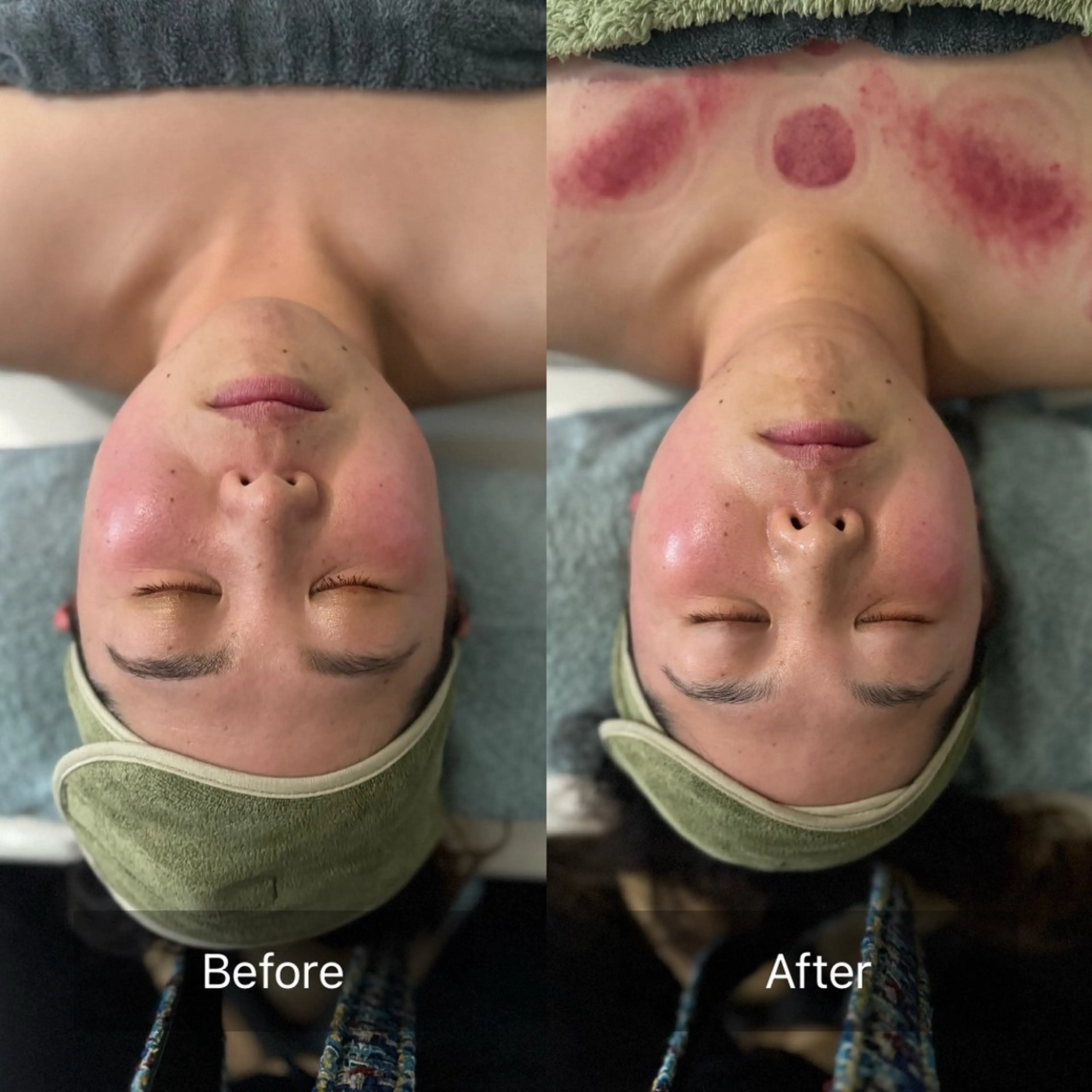 【80分 フェイシャルかっさ 至福のひととき】クレンジング​〜​マッサージ​〜​パック​〜​整肌　　　　　¥8,900の写真