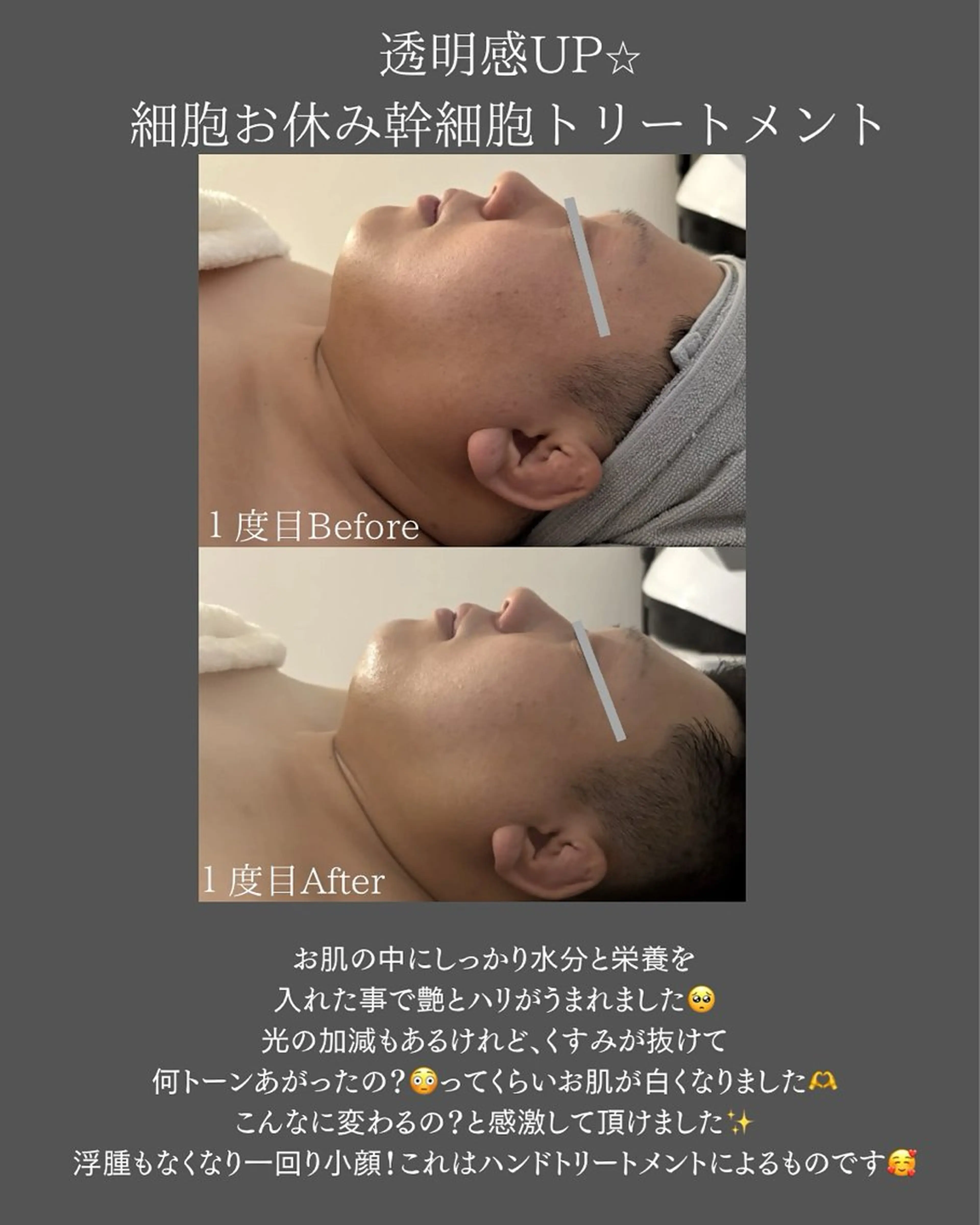 BLOSSOM 菊地のエステ・リラクイメージ