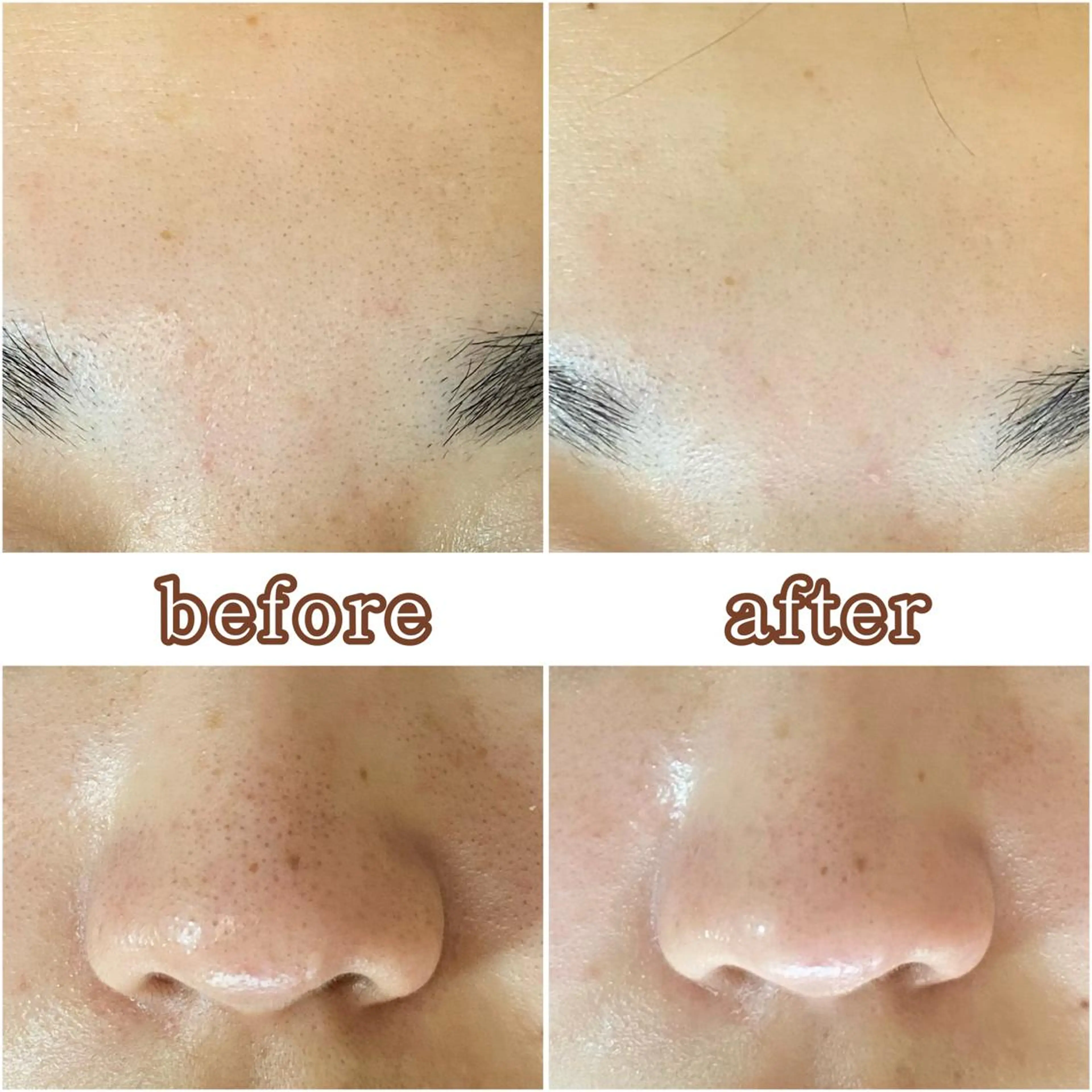 毛穴専門サロン フルール所属・フルールFululu 自由が丘のエステ・リラクイメージ