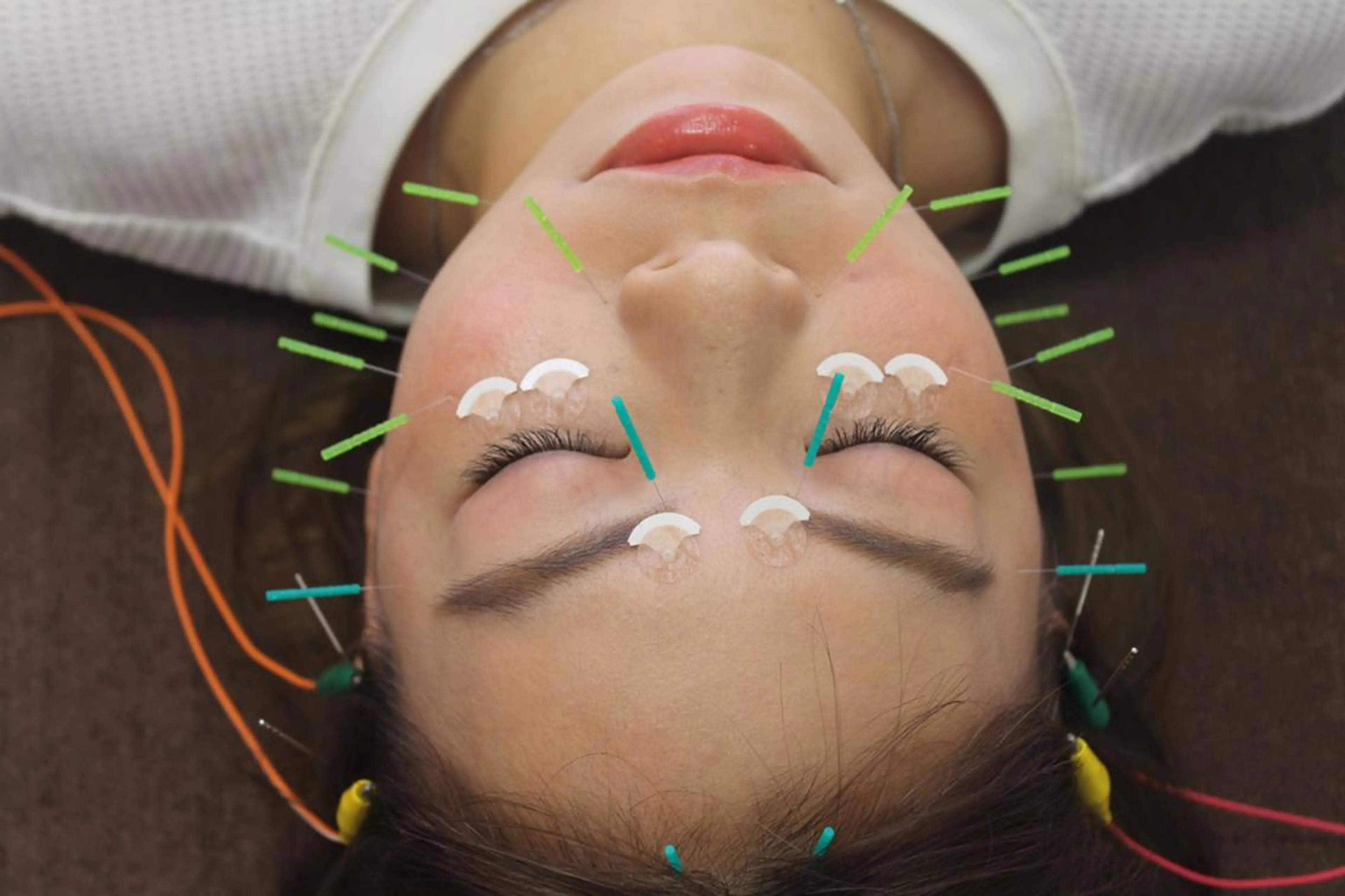 同心整骨院 美容鍼・整体・小顔のエステ・リラクイメージ