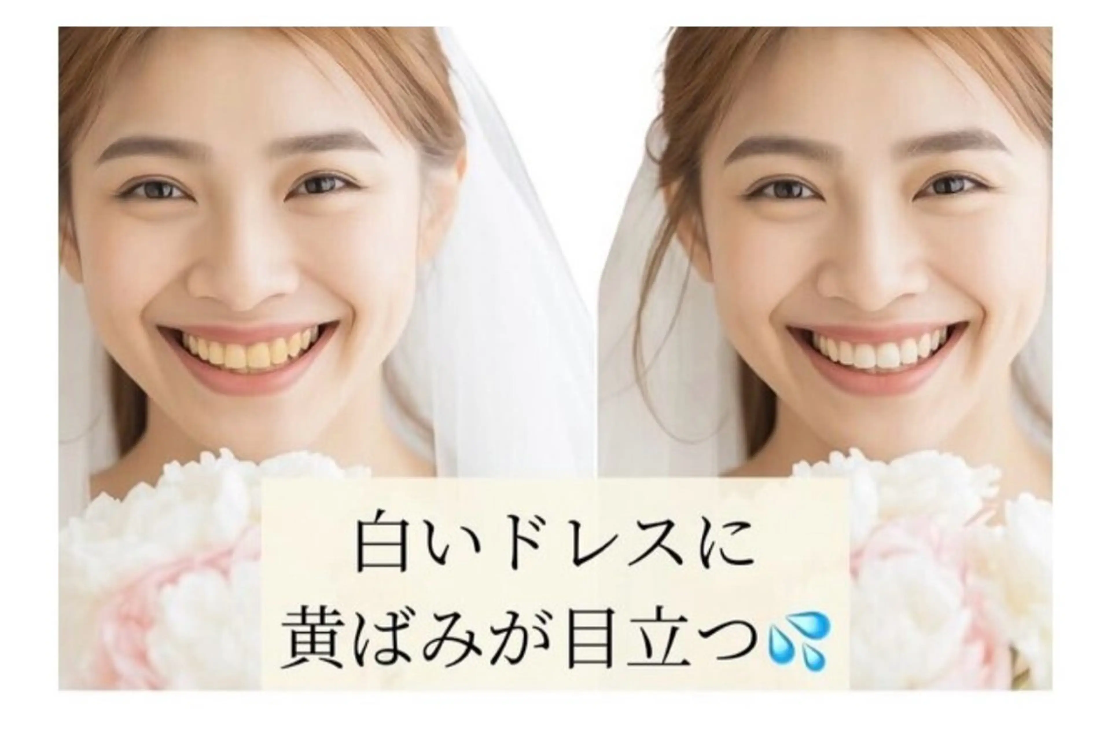 メンズ NAホワイトニング所属・NAホワイトニング /自由が丘のエステ・リラクイメージ