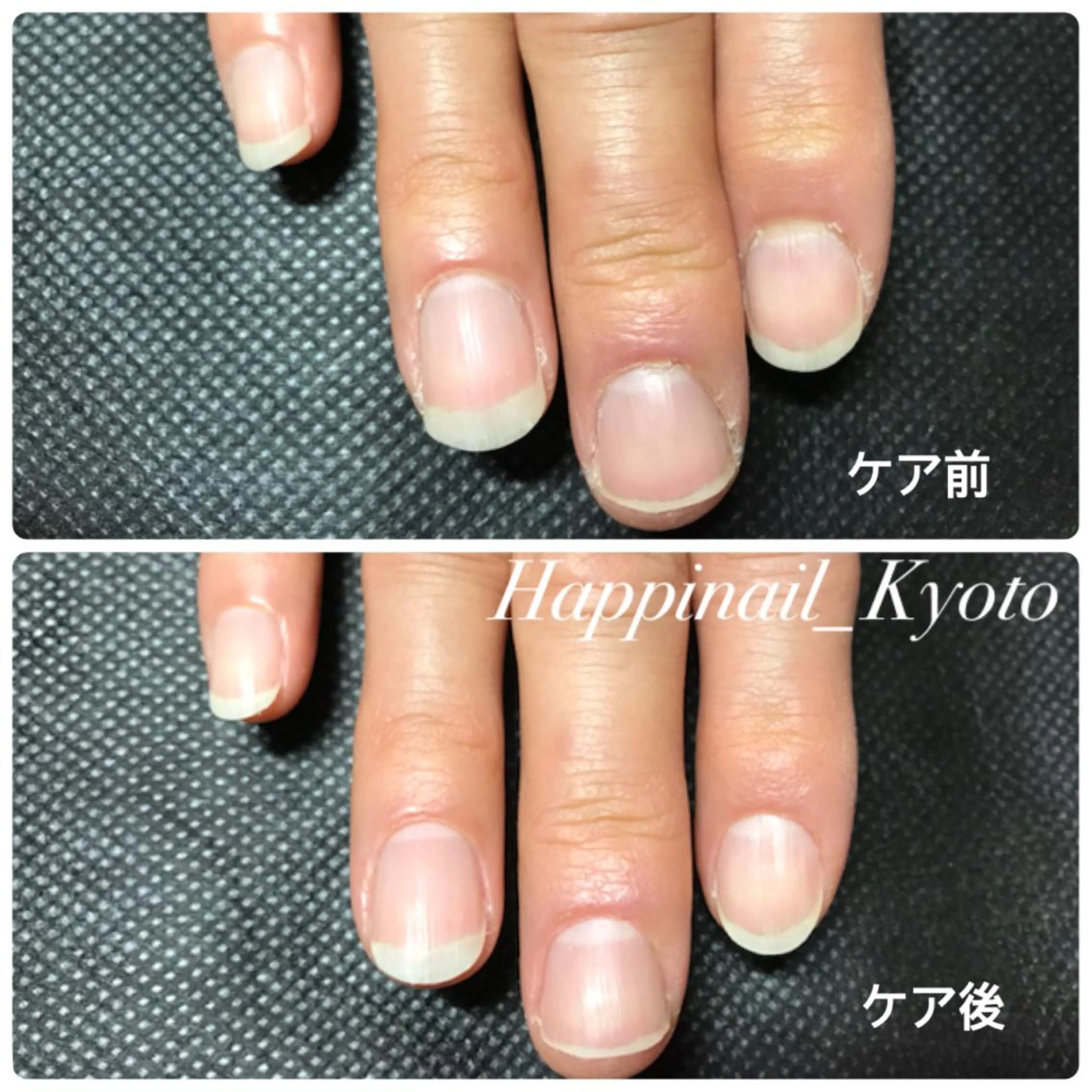 ネイル ケアが得意なサロン Happinailのエステ・リラクイメージ