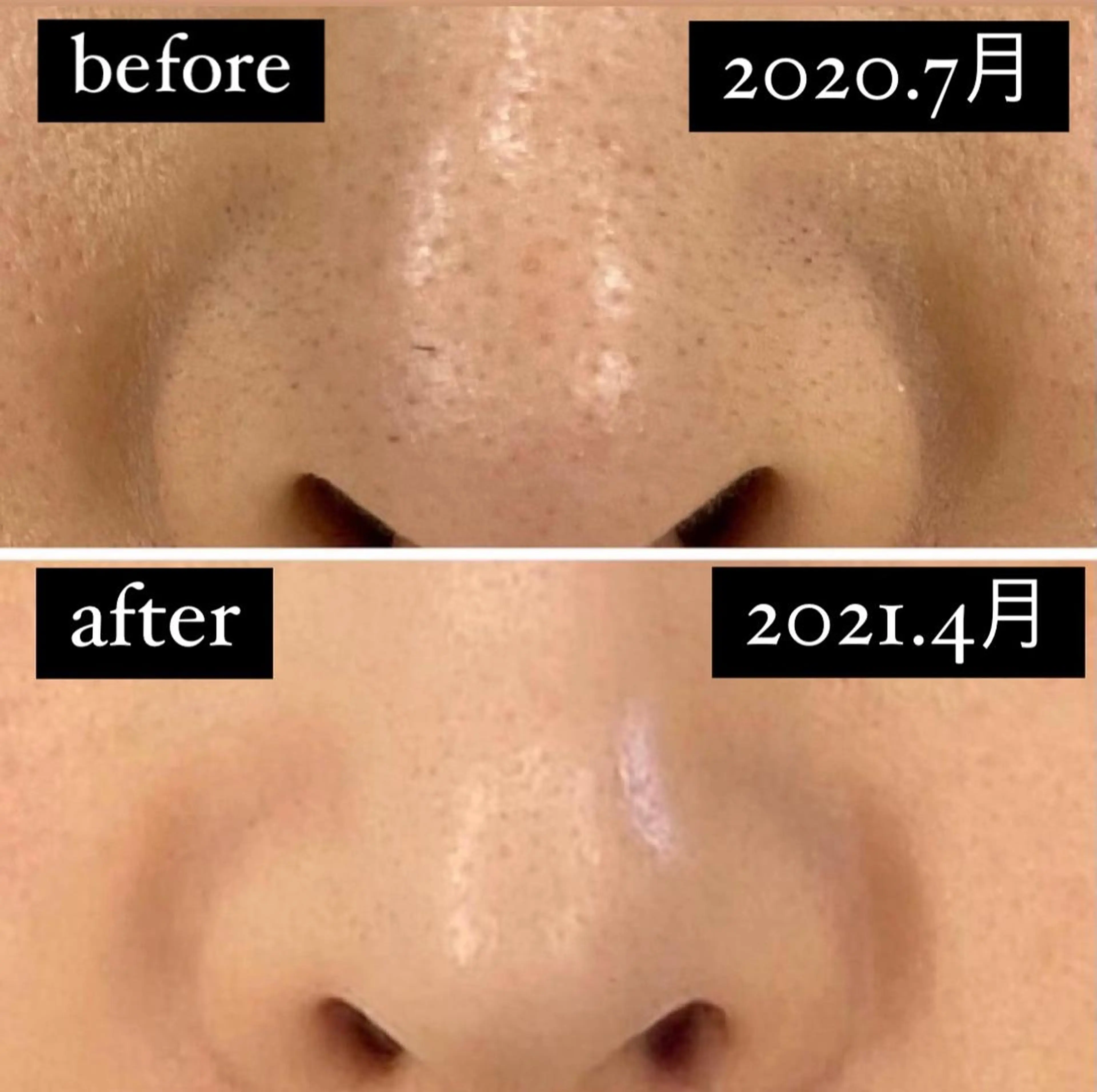 脱毛美容サロン1st ピーリング/ワックスの眉毛・アイブロウイメージ