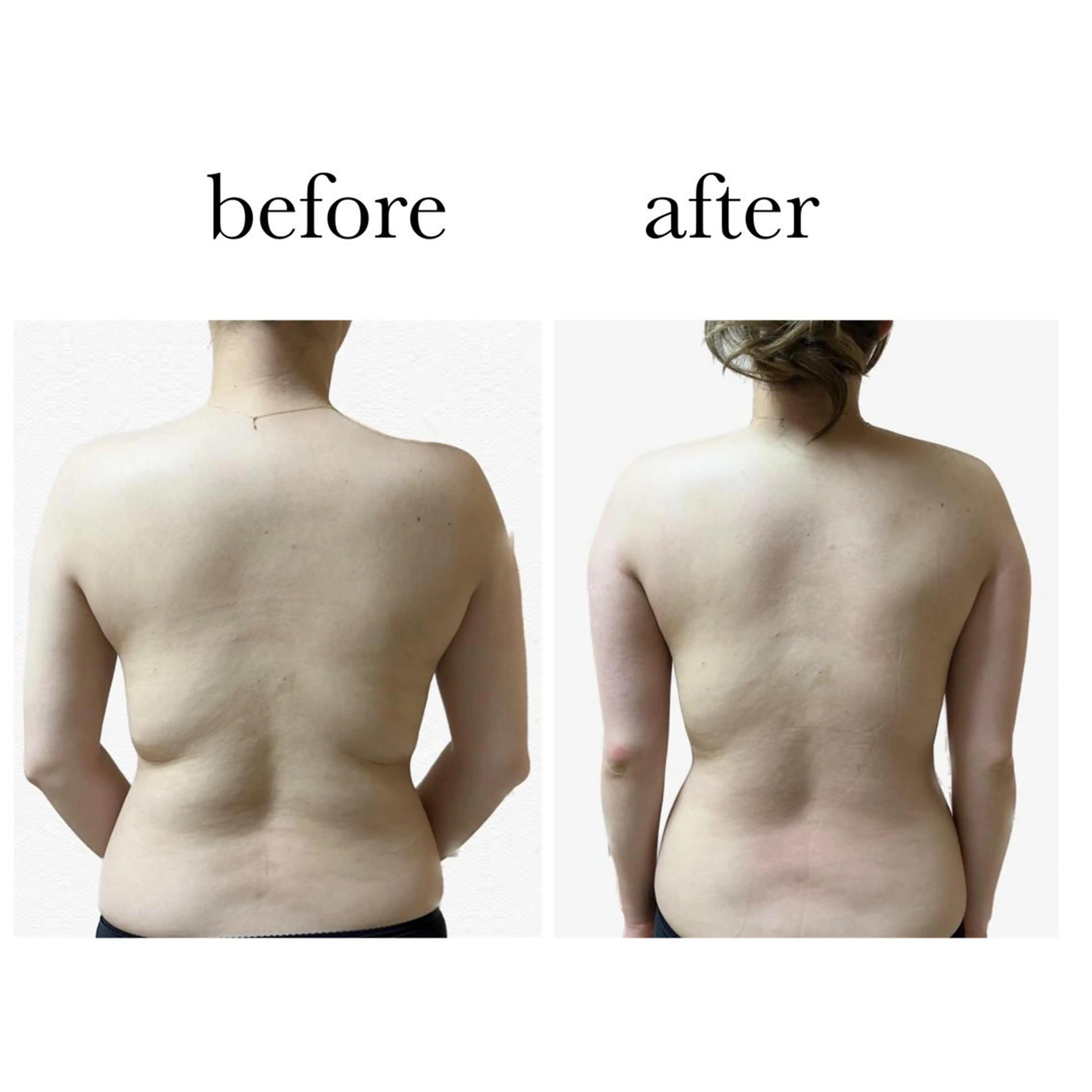 エステ stella都度払い 痩身小顔まつげパーマのマツエク・マツパデザイン