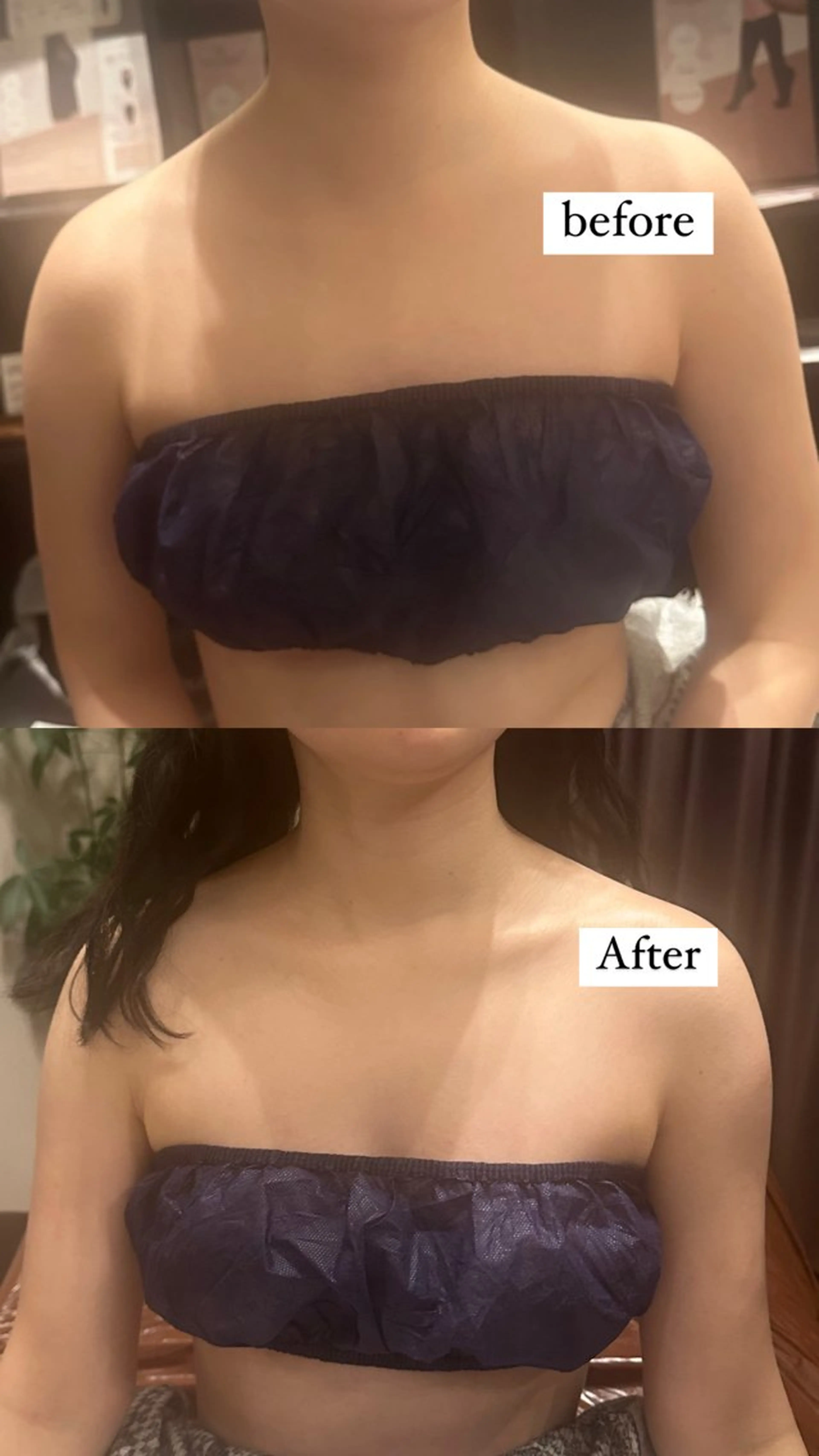 エステ 浮腫|肩こり|張り 日々の疲れを解消★のエステ・リラクイメージ