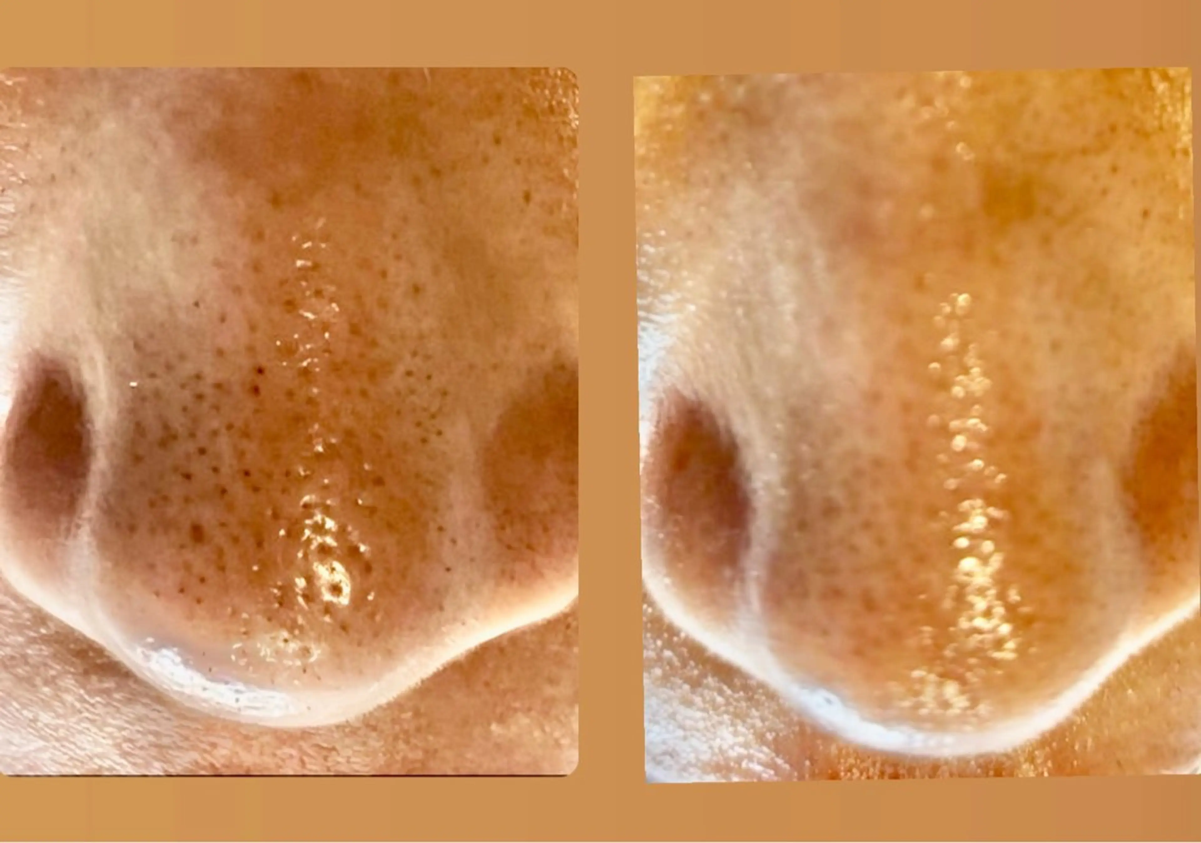 脱毛エステサロン PEAKのエステ・リラクイメージ