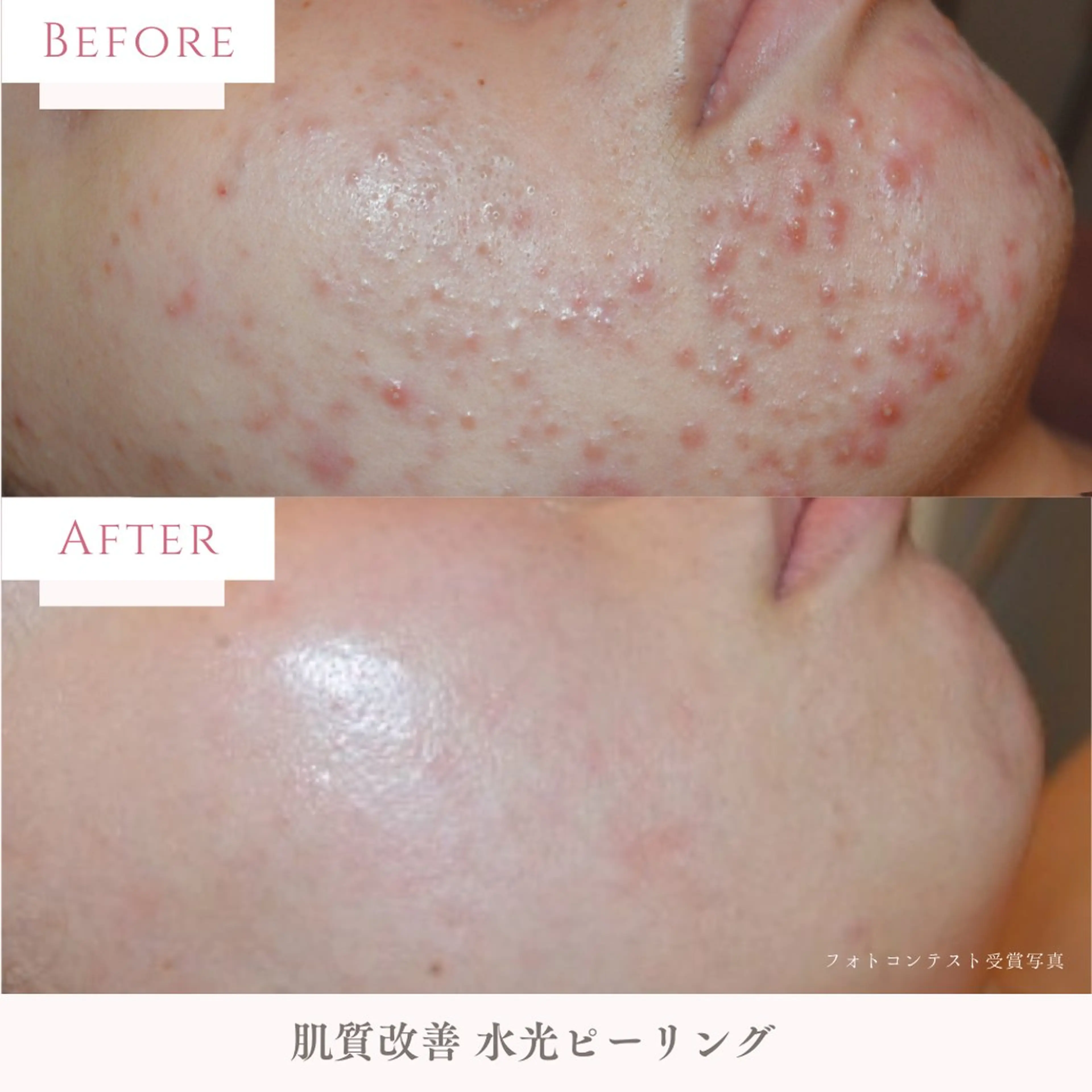 肌質改善サロン LesFleursのエステ・リラクイメージ