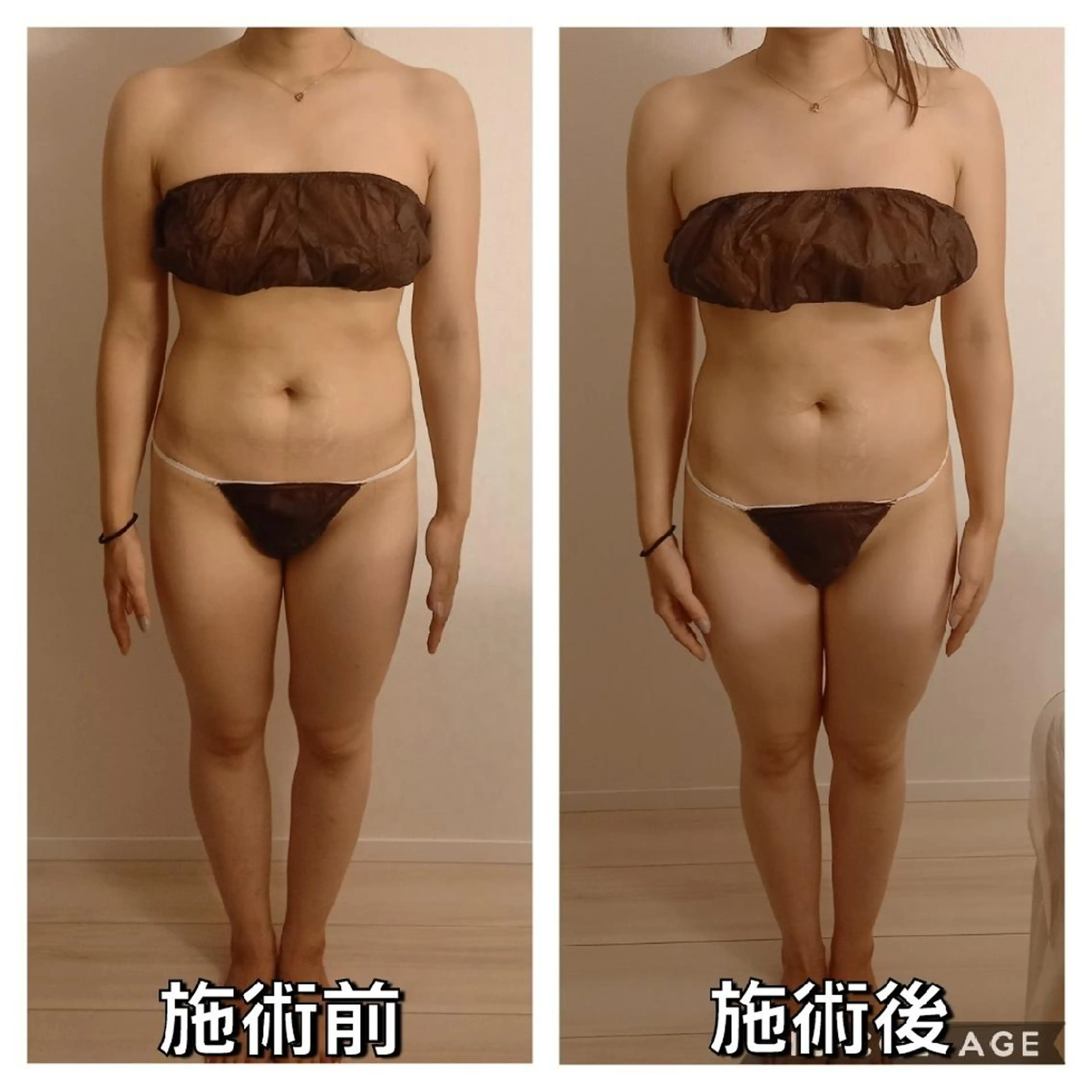 エステ リラク Risonowa plus所属・前田 優華里のエステ・リラクイメージ