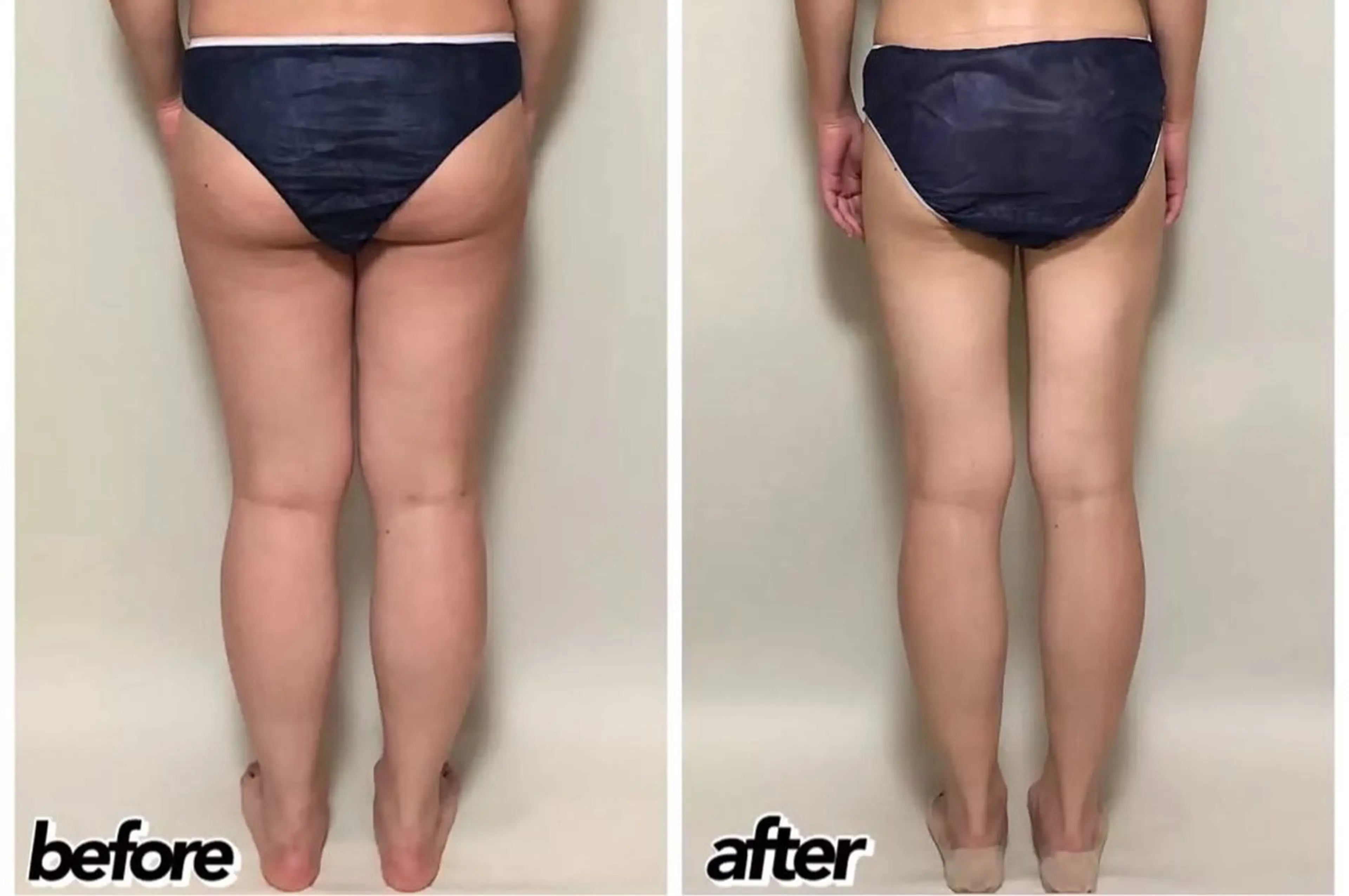 エステ リラク salon lady_goのエステ・リラクイメージ