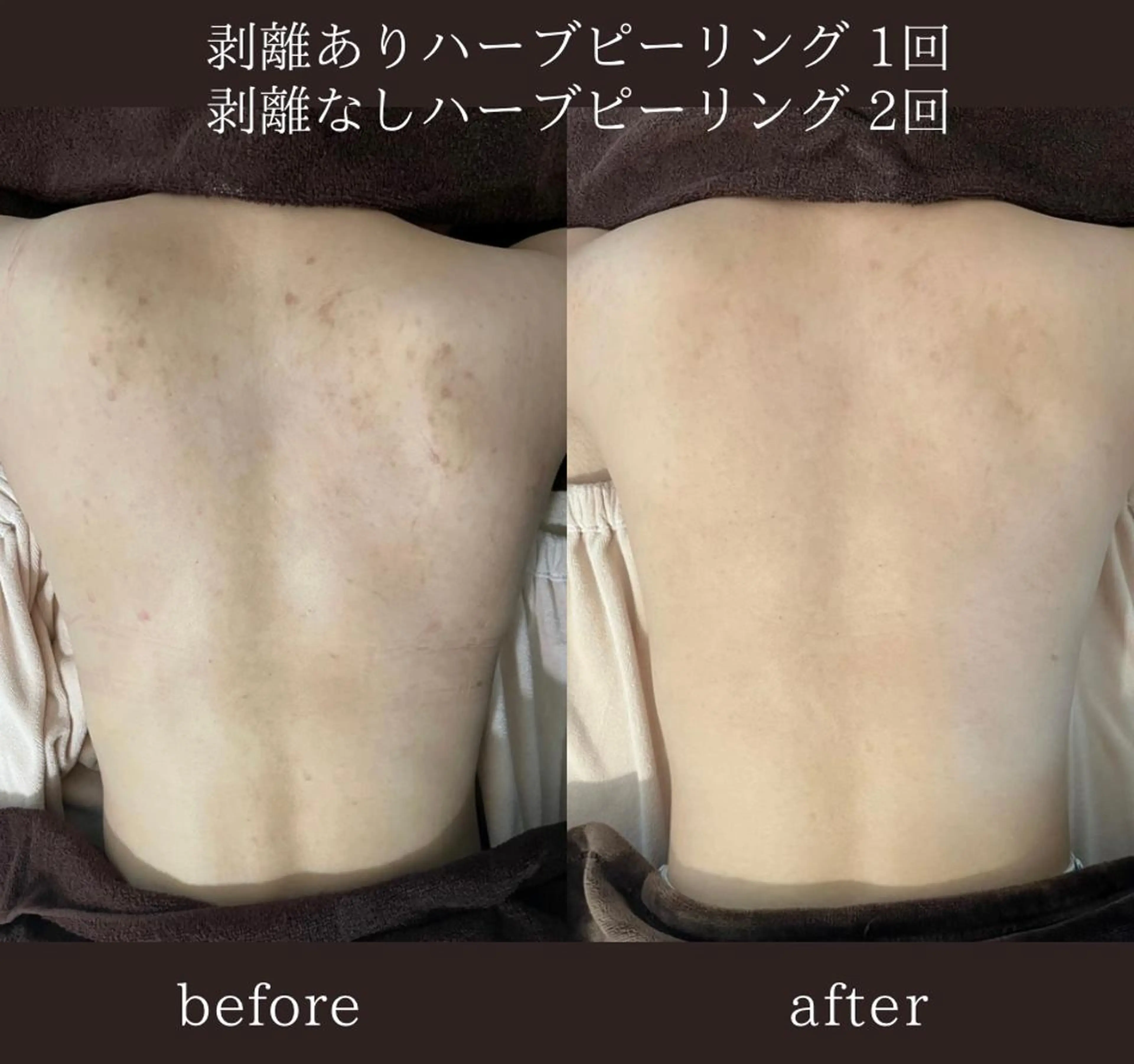 美肌ケアサロン iru【アイル】のエステ・リラクイメージ