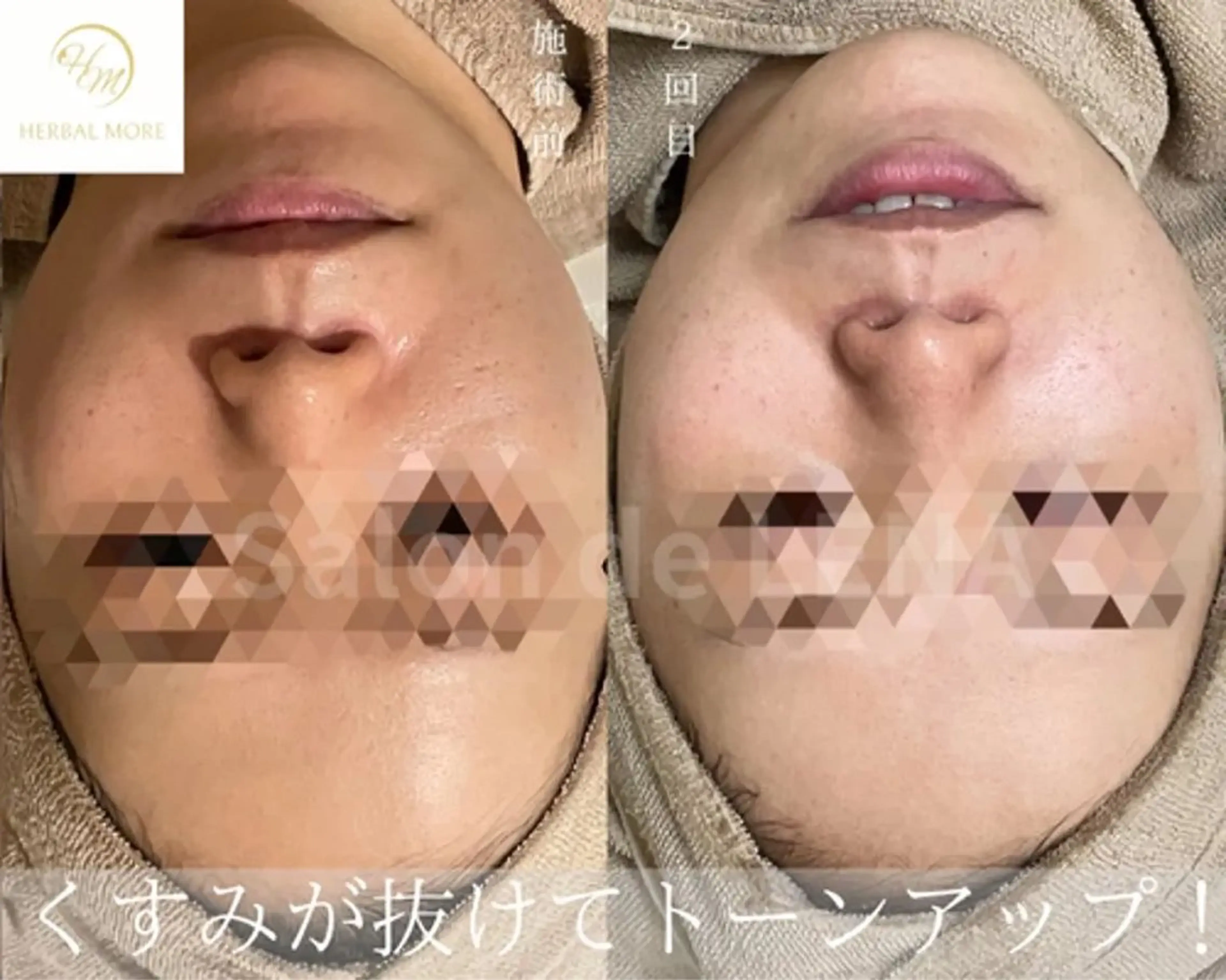 ハーブピーリング専門 グランディール　武内のエステ・リラクイメージ