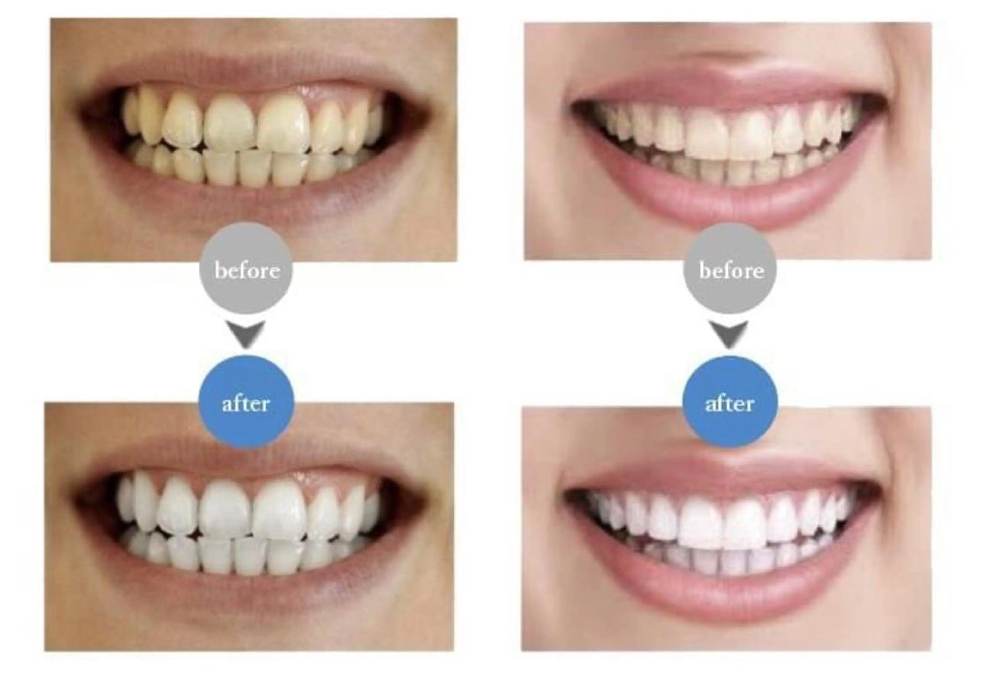 Ｍ渋谷 ホワイトニングのエステ・リラクイメージ