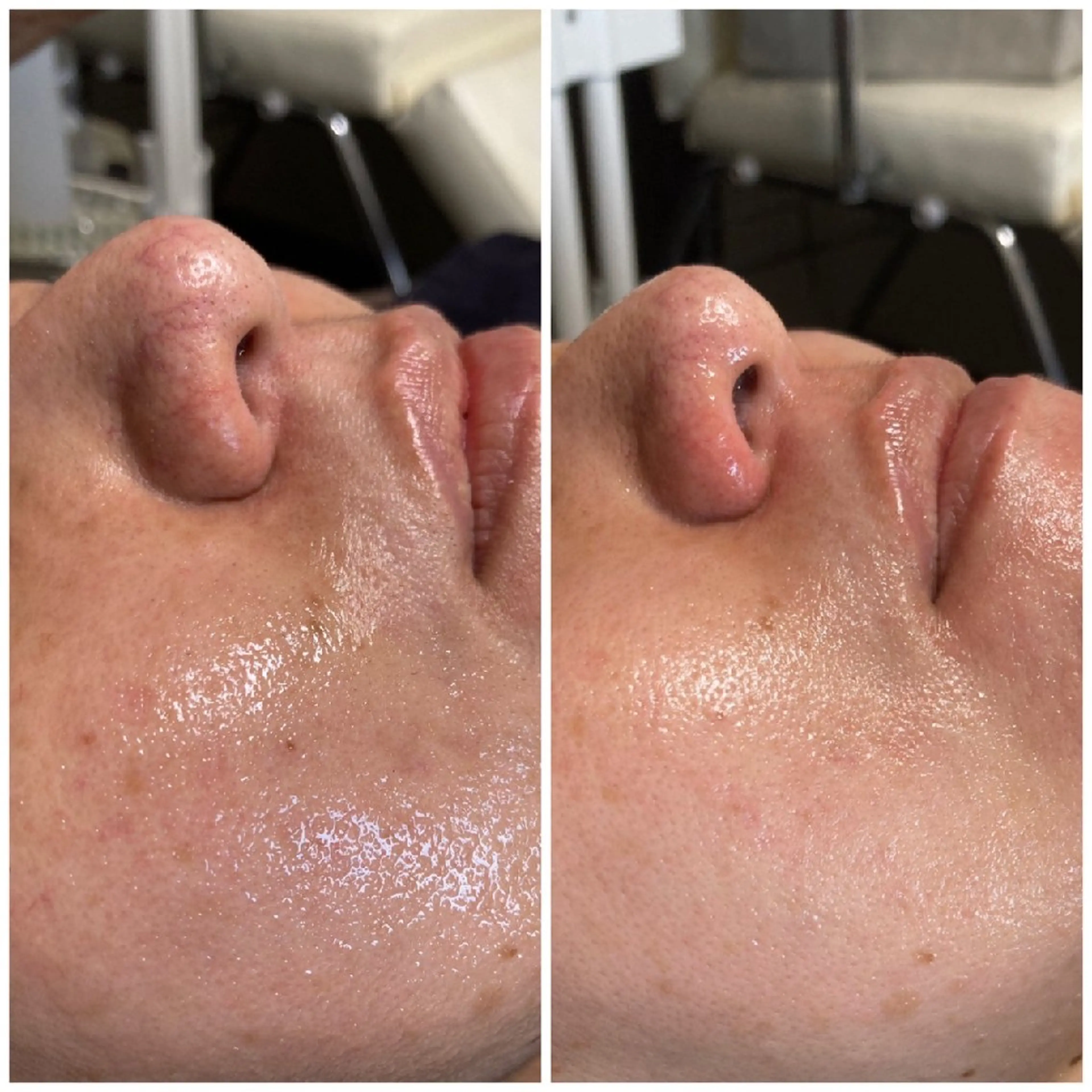 当店限定オリジナルうどんパックコースの写真