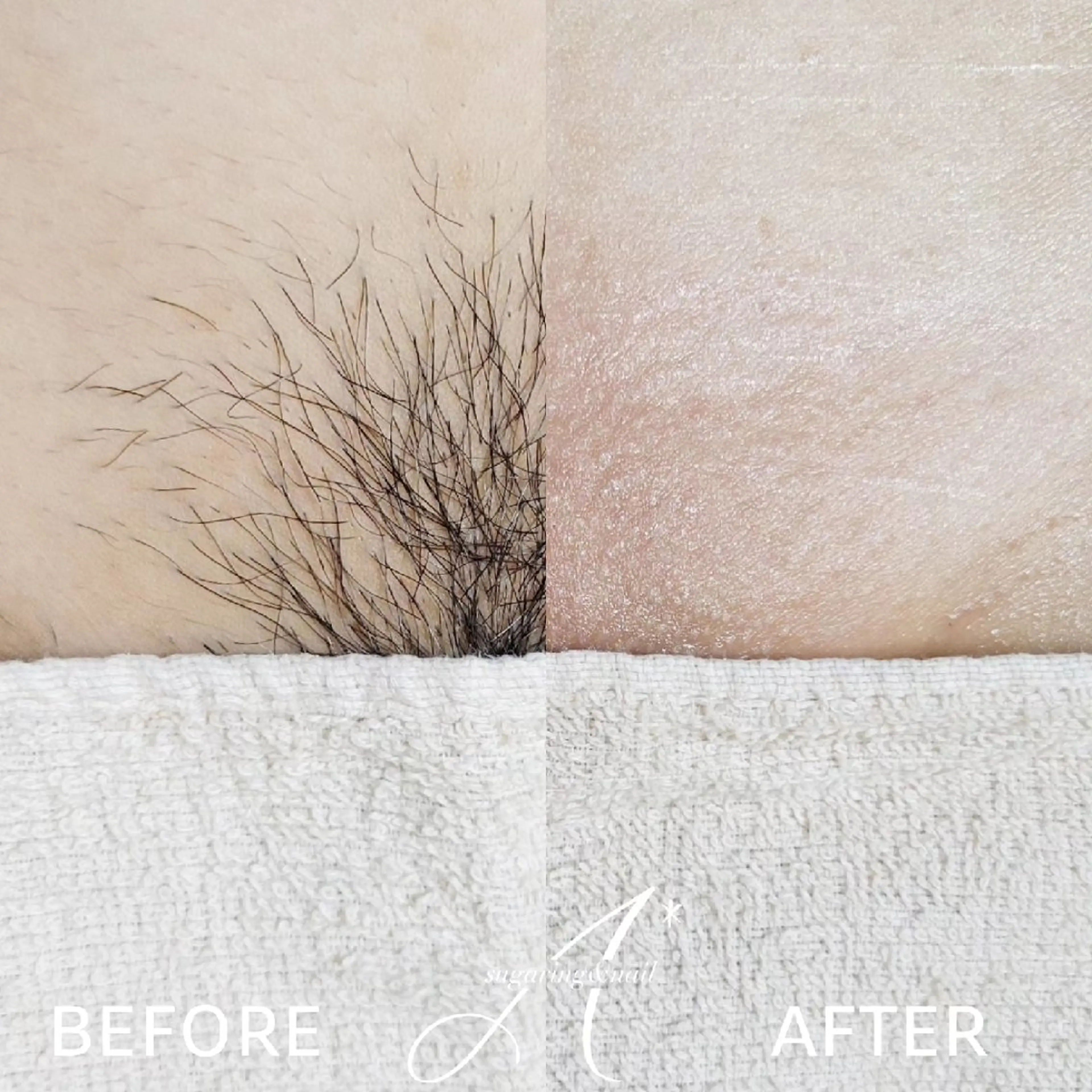 A*《エースター》 シュガーリング🍋のエステ・リラクイメージ