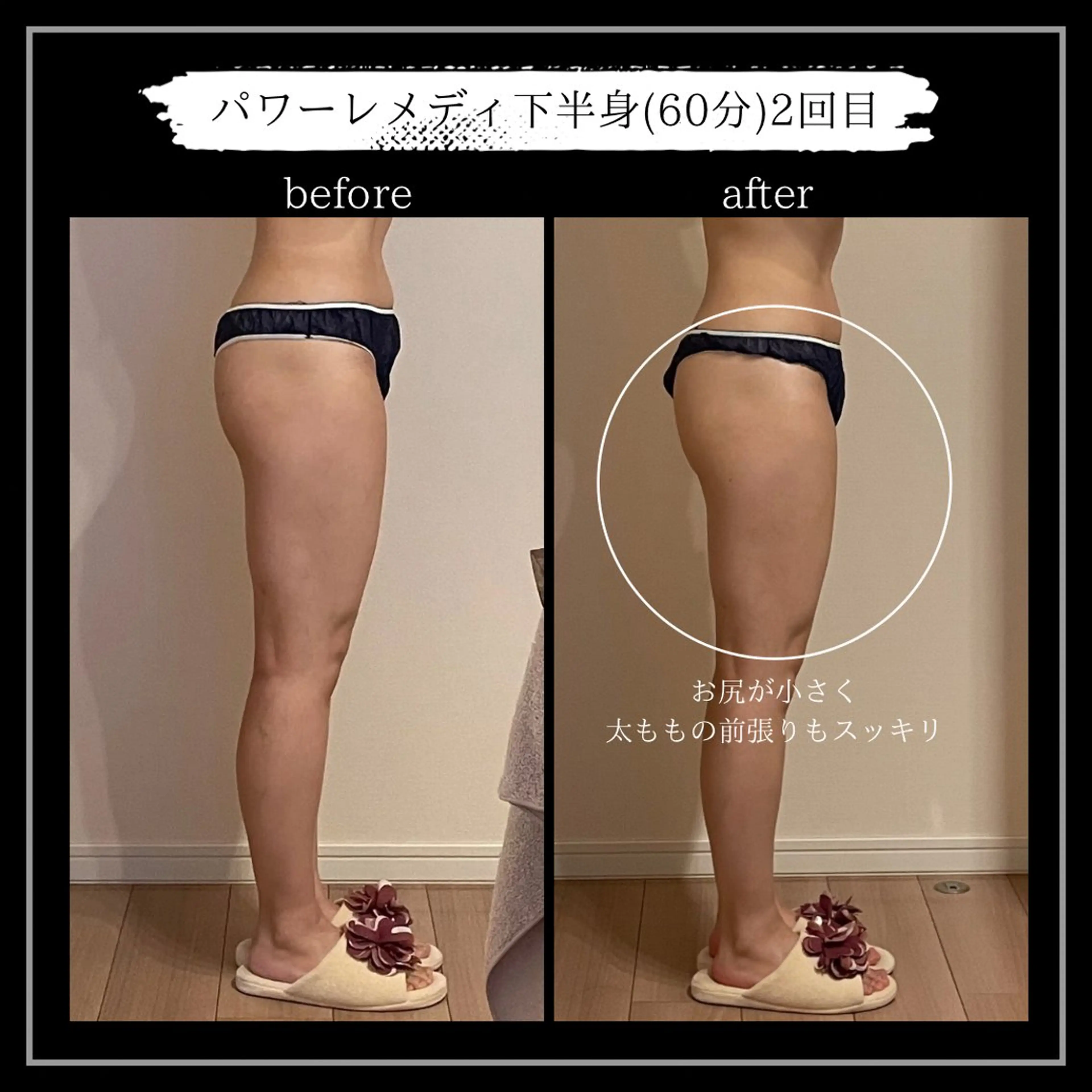 オフ:オン 全身筋膜マッサージのエステ・リラクイメージ