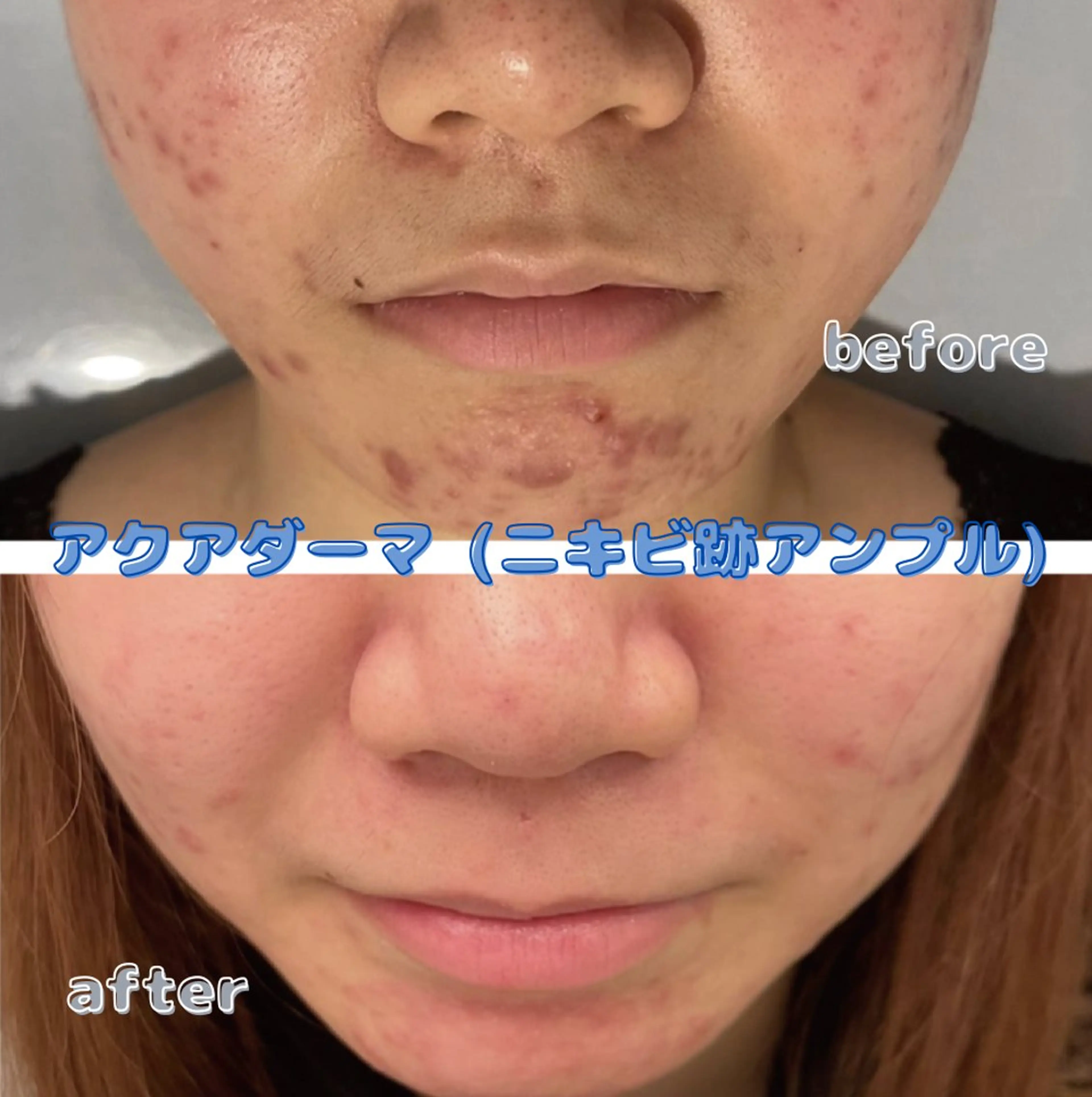 看護師が施術する美容 ナスサロ/川口のエステ・リラクイメージ