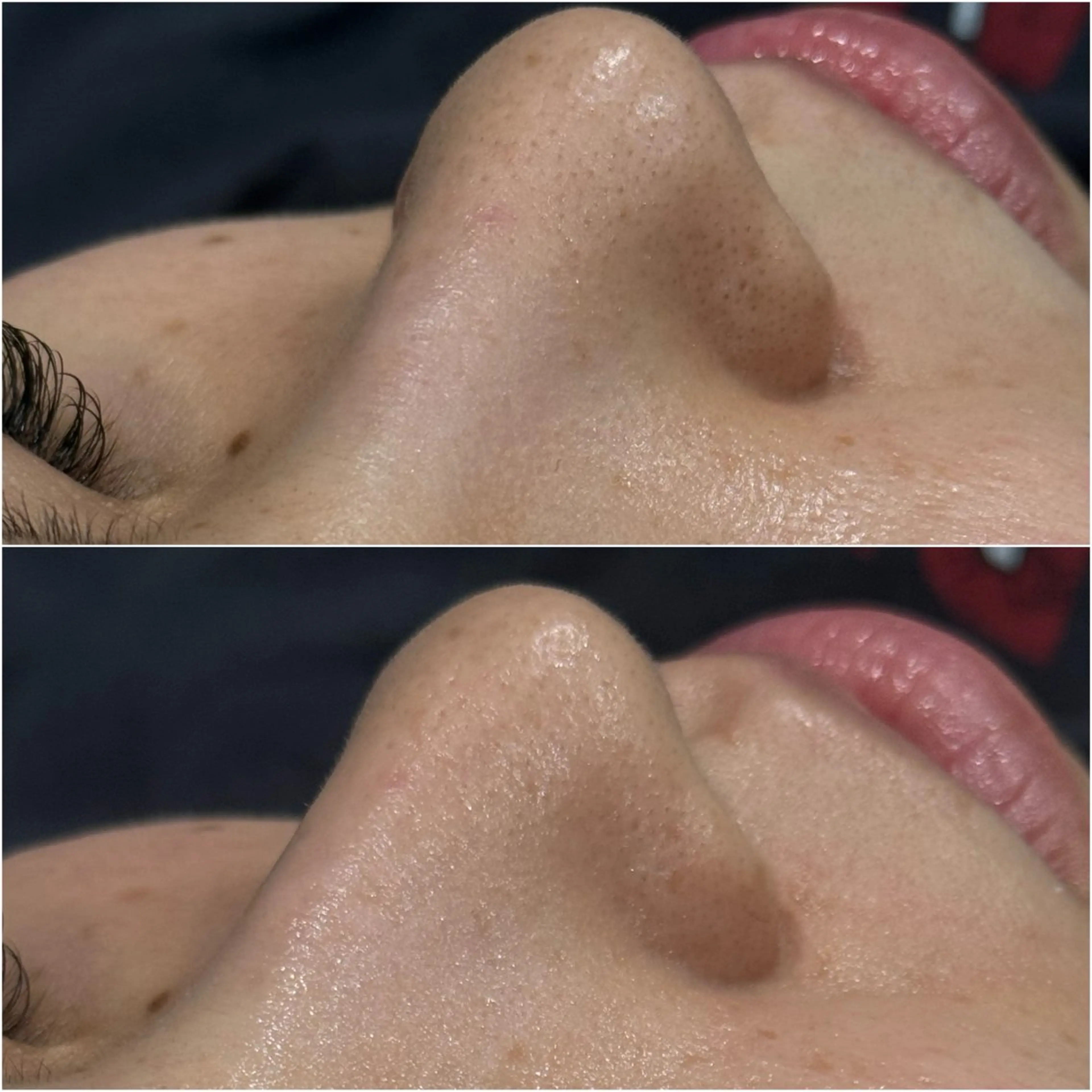 LiZA エステティックサロンのエステ・リラクイメージ