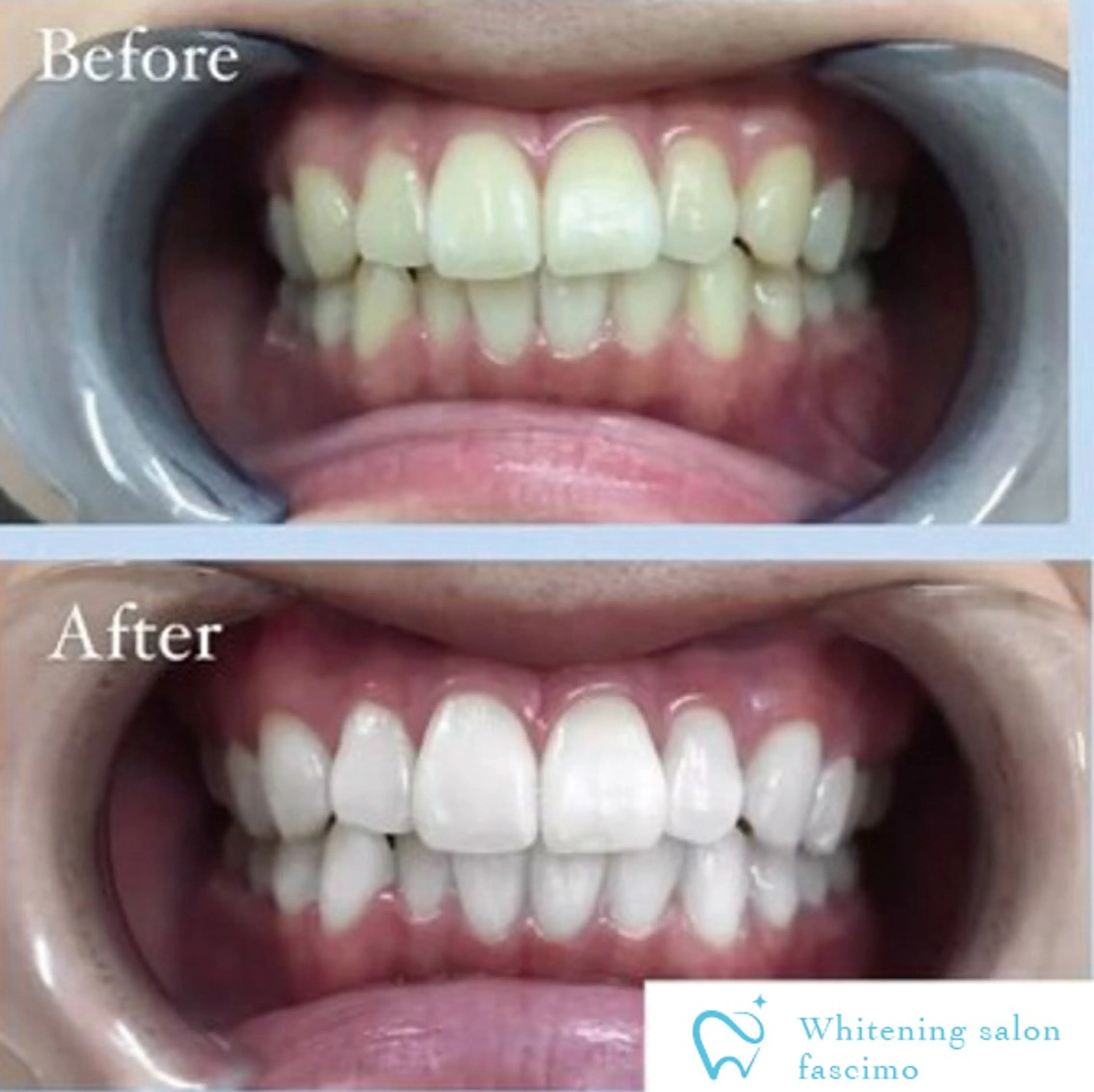 その他 ホワイトニングサロン fascimo新座店のその他イメージ