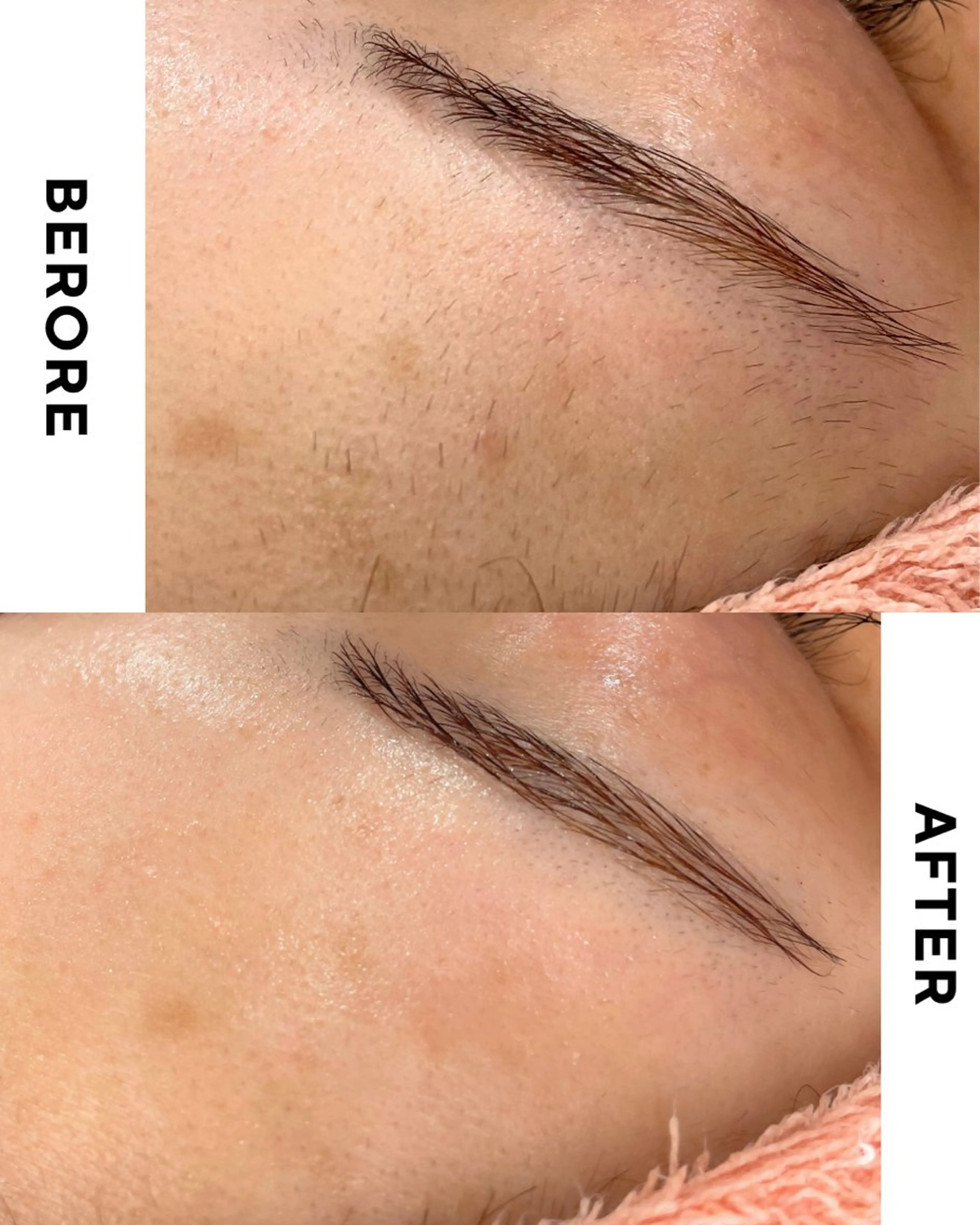 脱毛 肌質改善専門サロン Bellmi/心斎橋のエステ・リラクイメージ