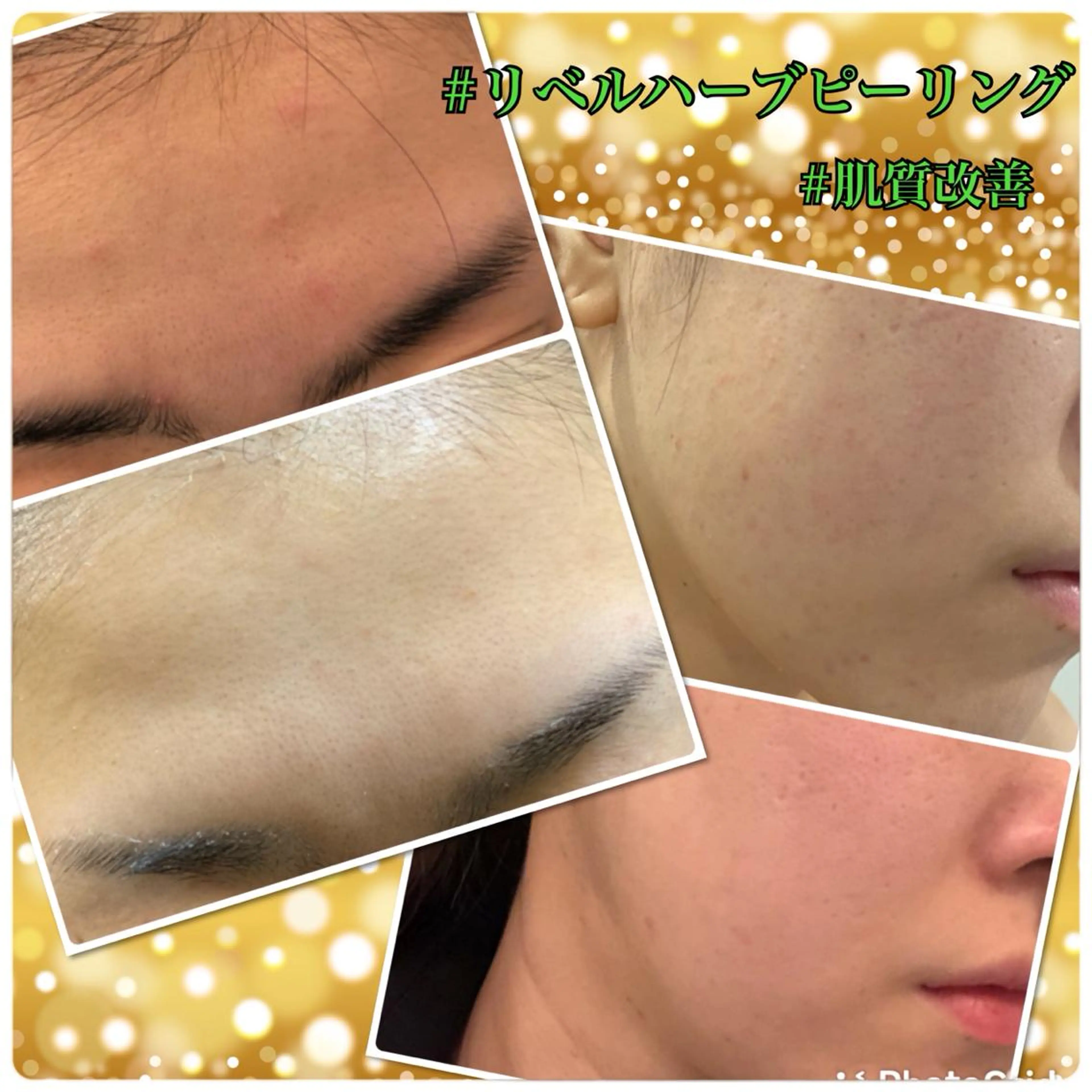 エステ Dione 立川店のエステ・リラクイメージ